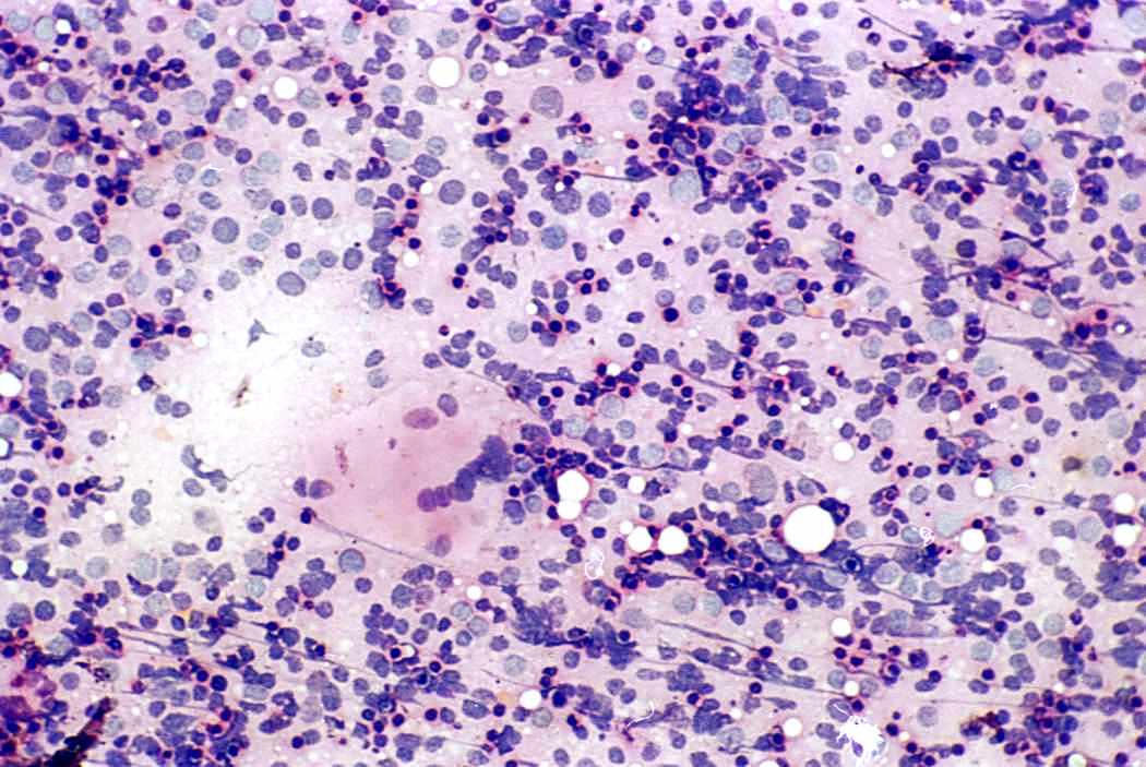 Right lobe, longitudinal scan