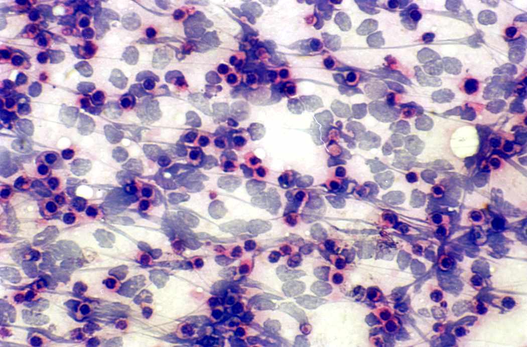 Right lobe, longitudinal scan