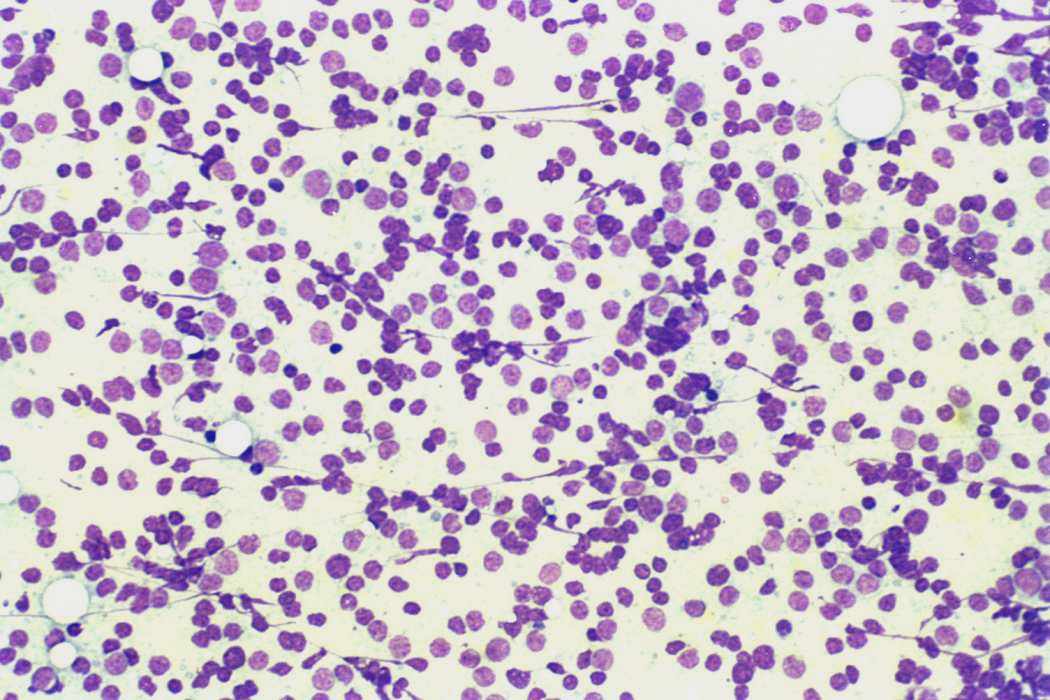 Right lobe, longitudinal scan