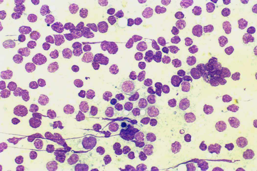 Right lobe, longitudinal scan