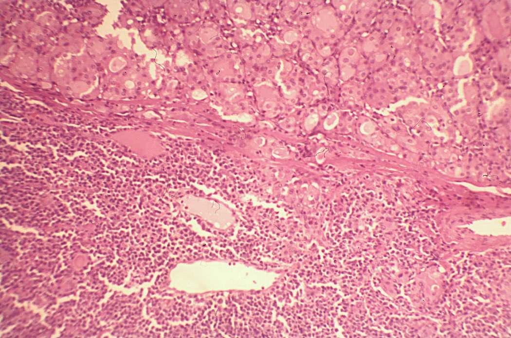 Right lobe, longitudinal scan