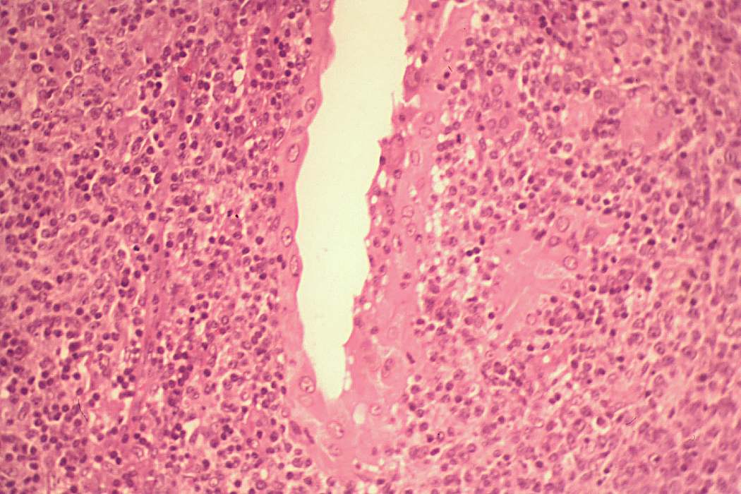 Right lobe, longitudinal scan