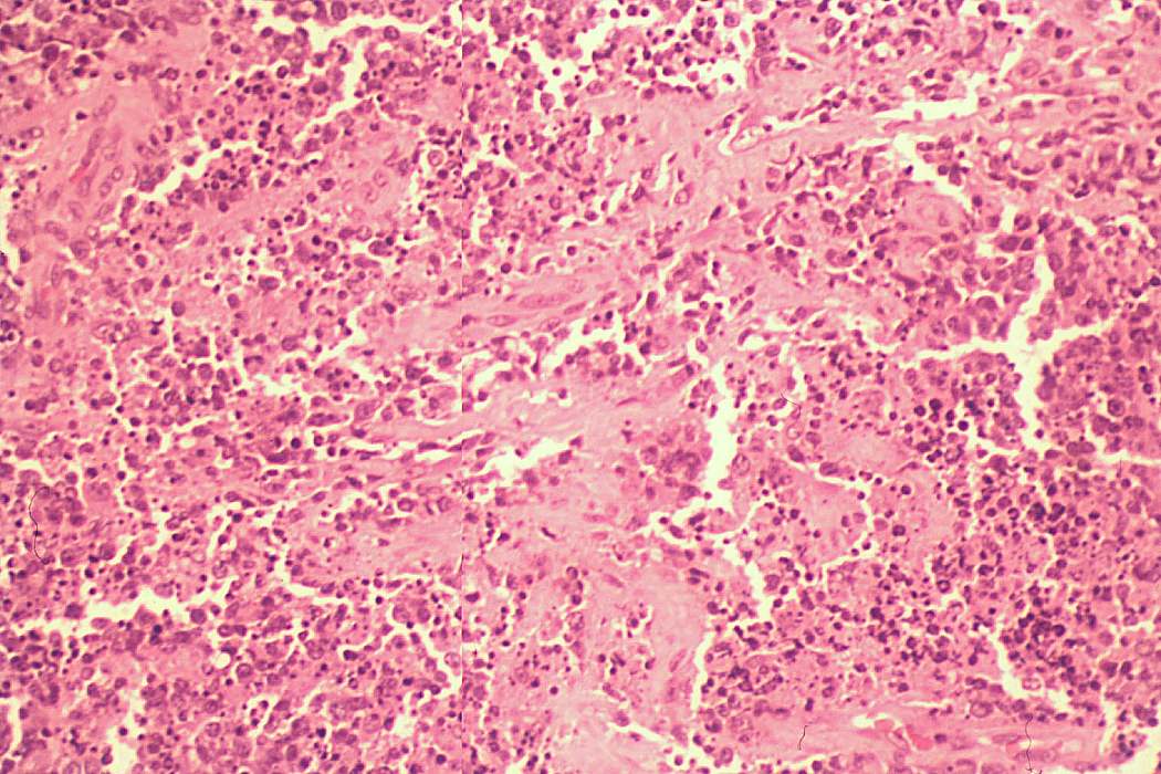 Right lobe, longitudinal scan