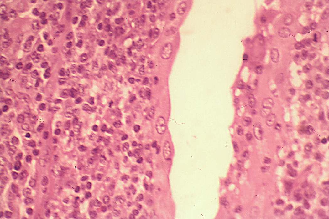 Right lobe, longitudinal scan