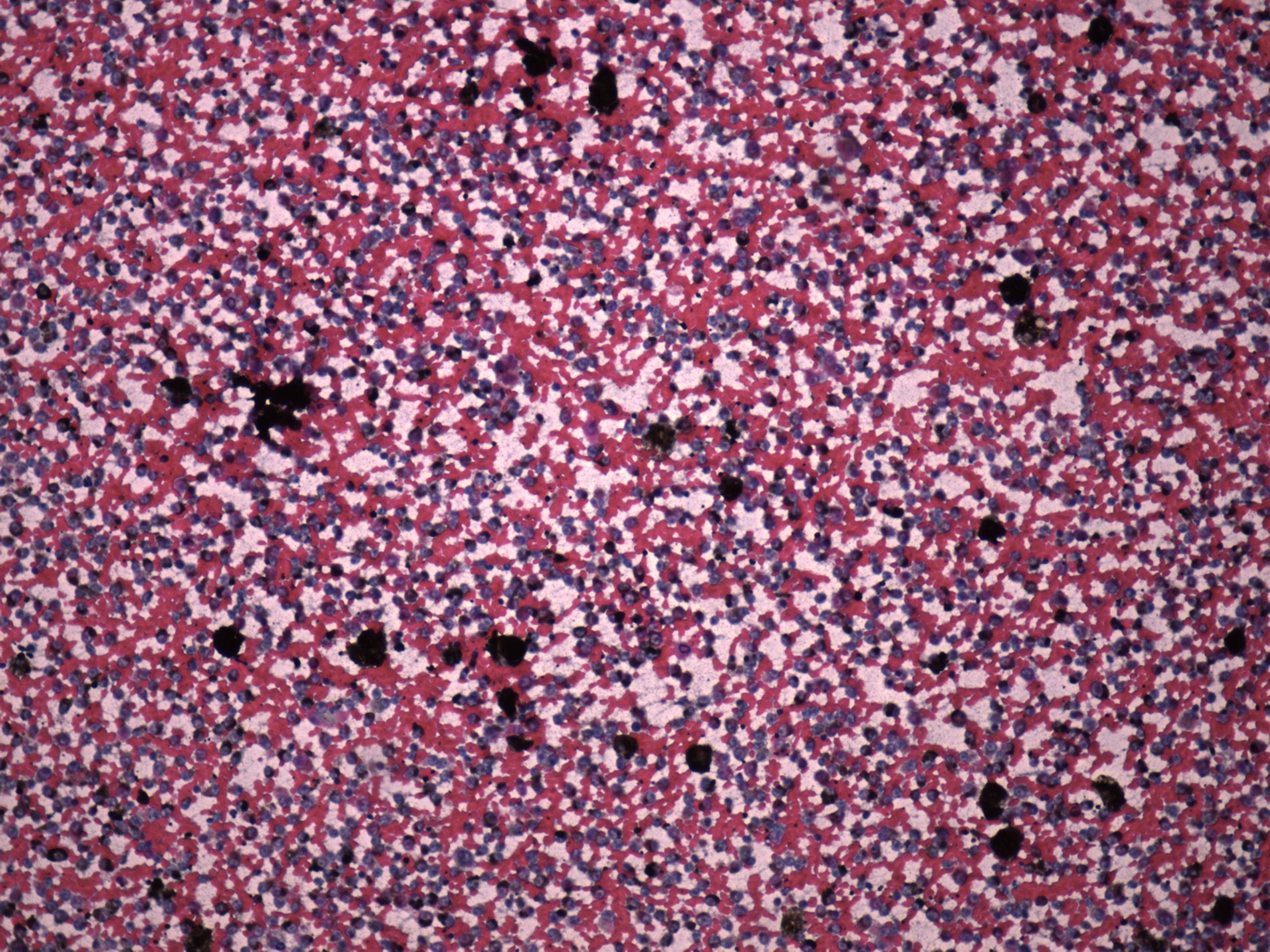 Right lobe, longitudinal scan