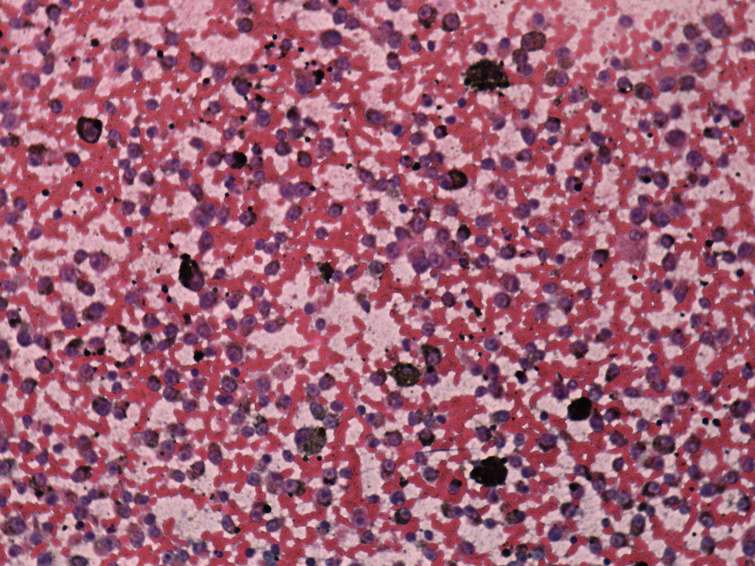 Right lobe, longitudinal scan