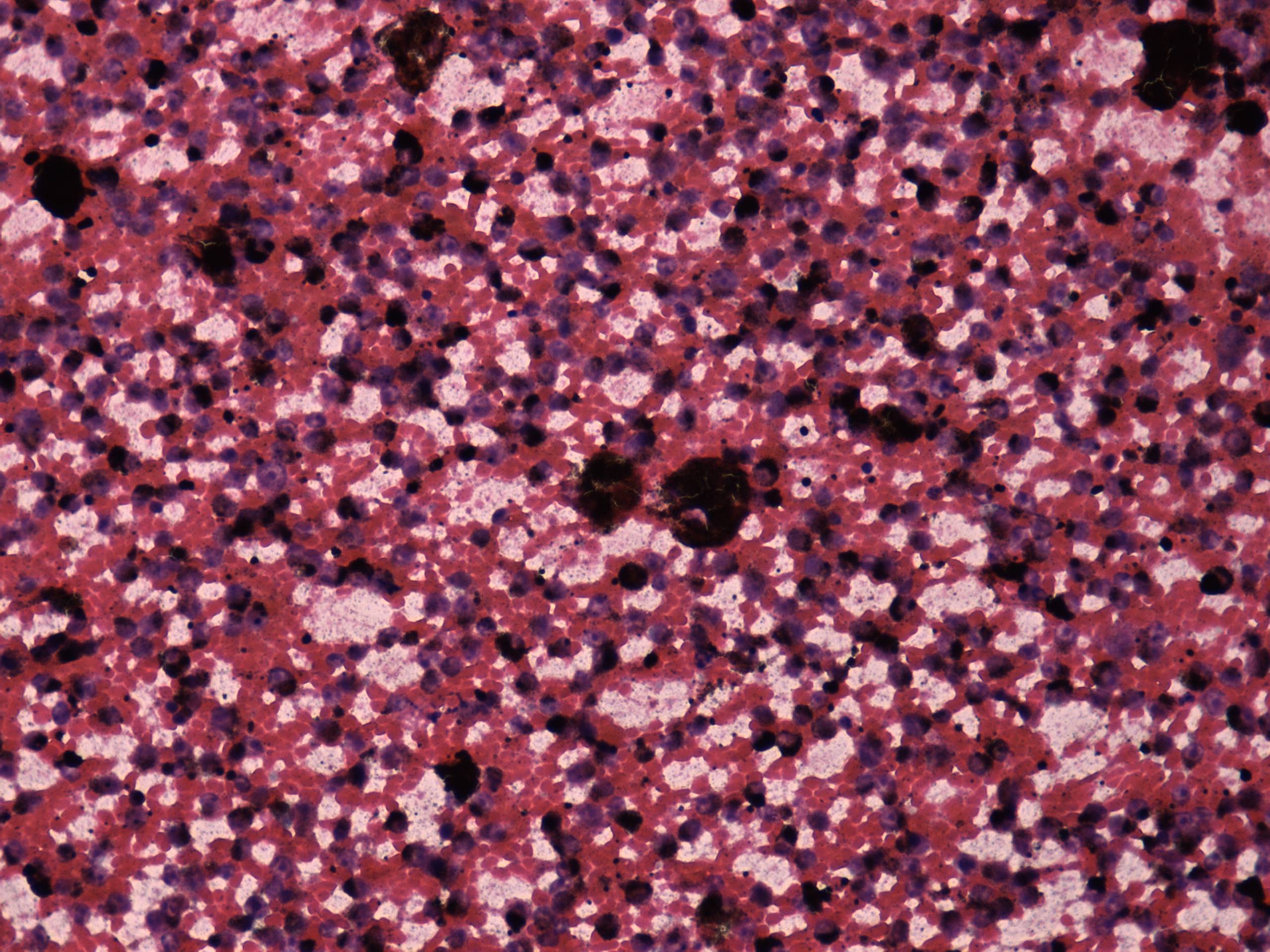 Right lobe, longitudinal scan