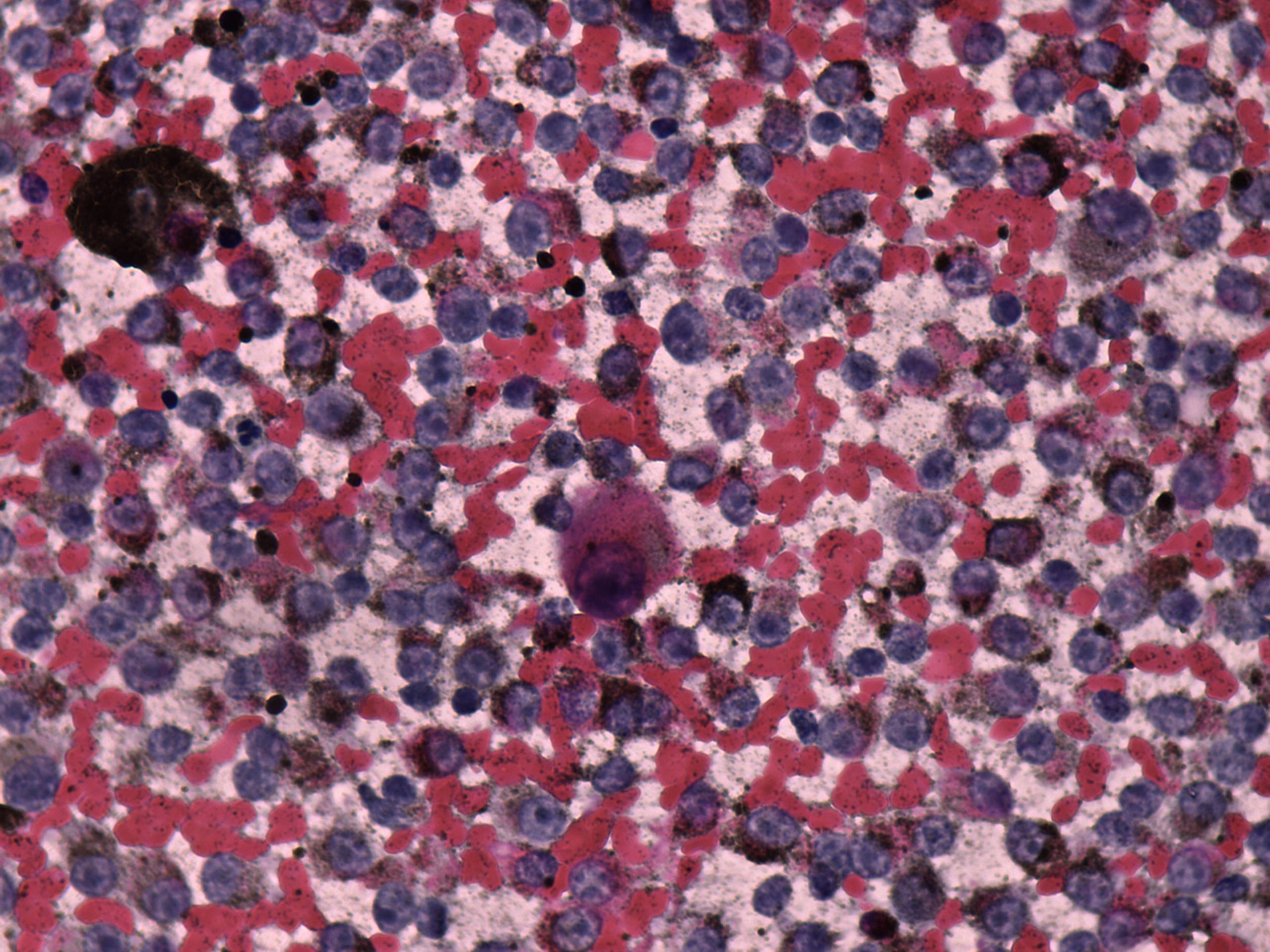 Right lobe, longitudinal scan