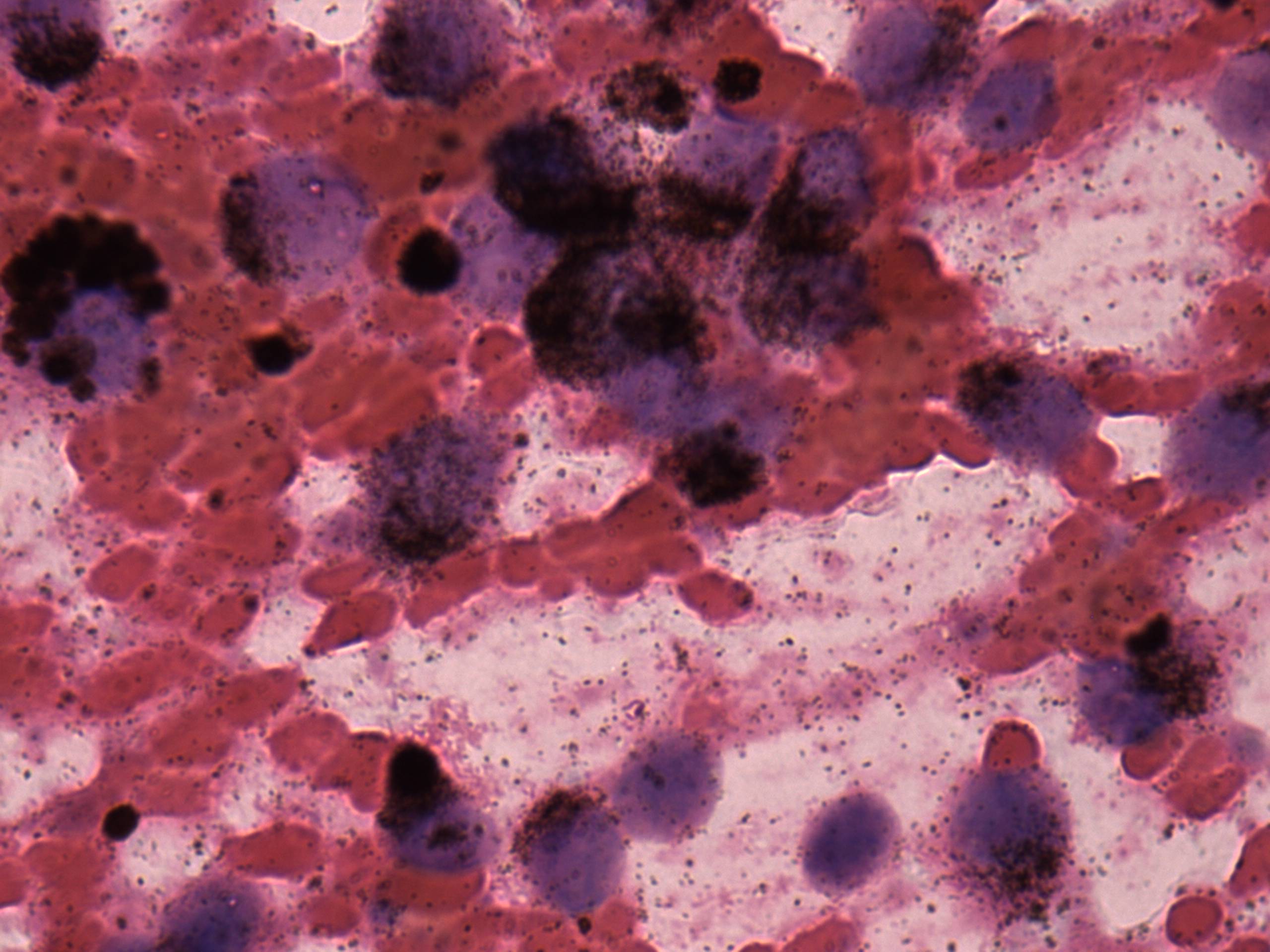 Right lobe, longitudinal scan