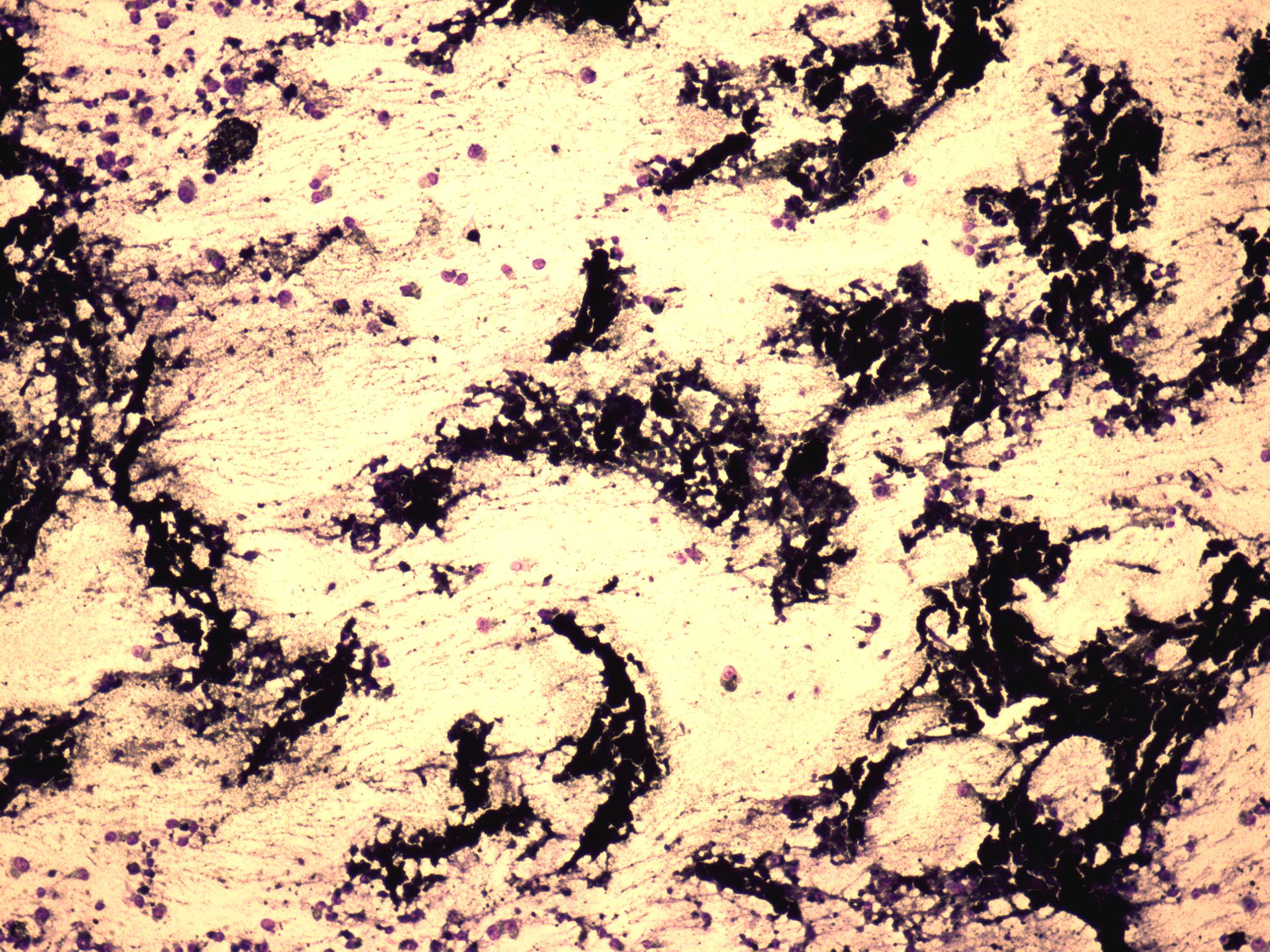 Right lobe, longitudinal scan