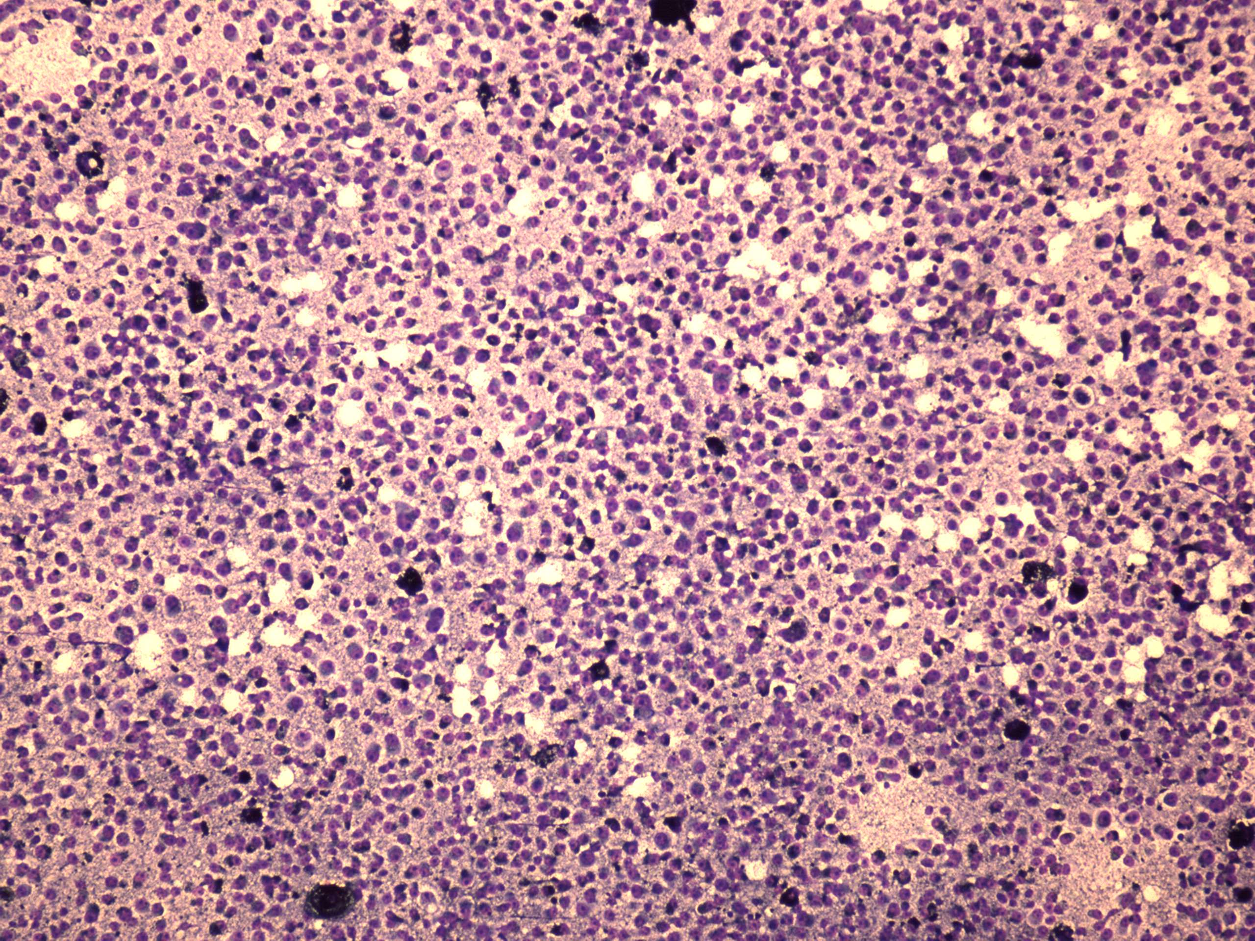 Right lobe, longitudinal scan