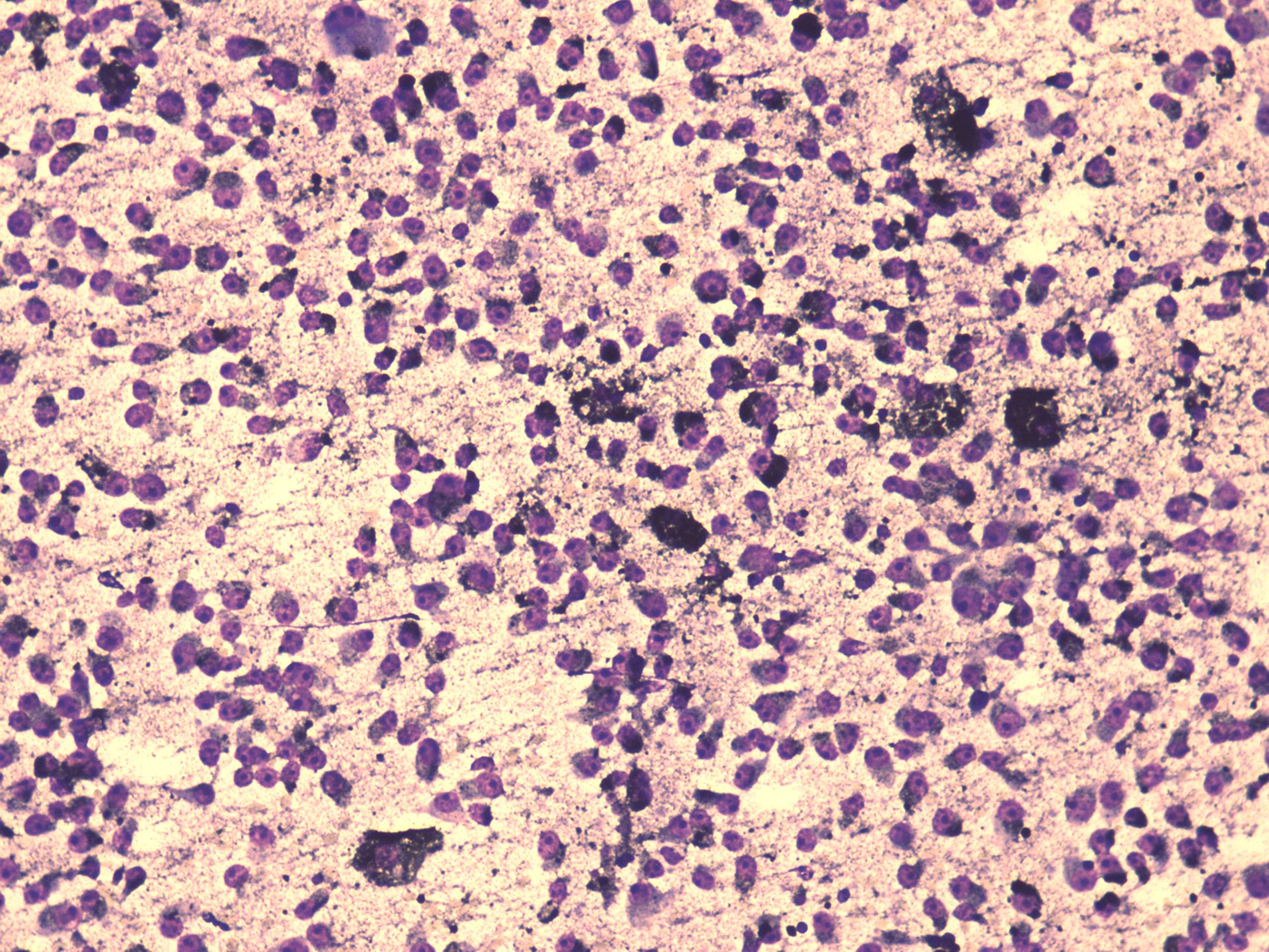Right lobe, longitudinal scan