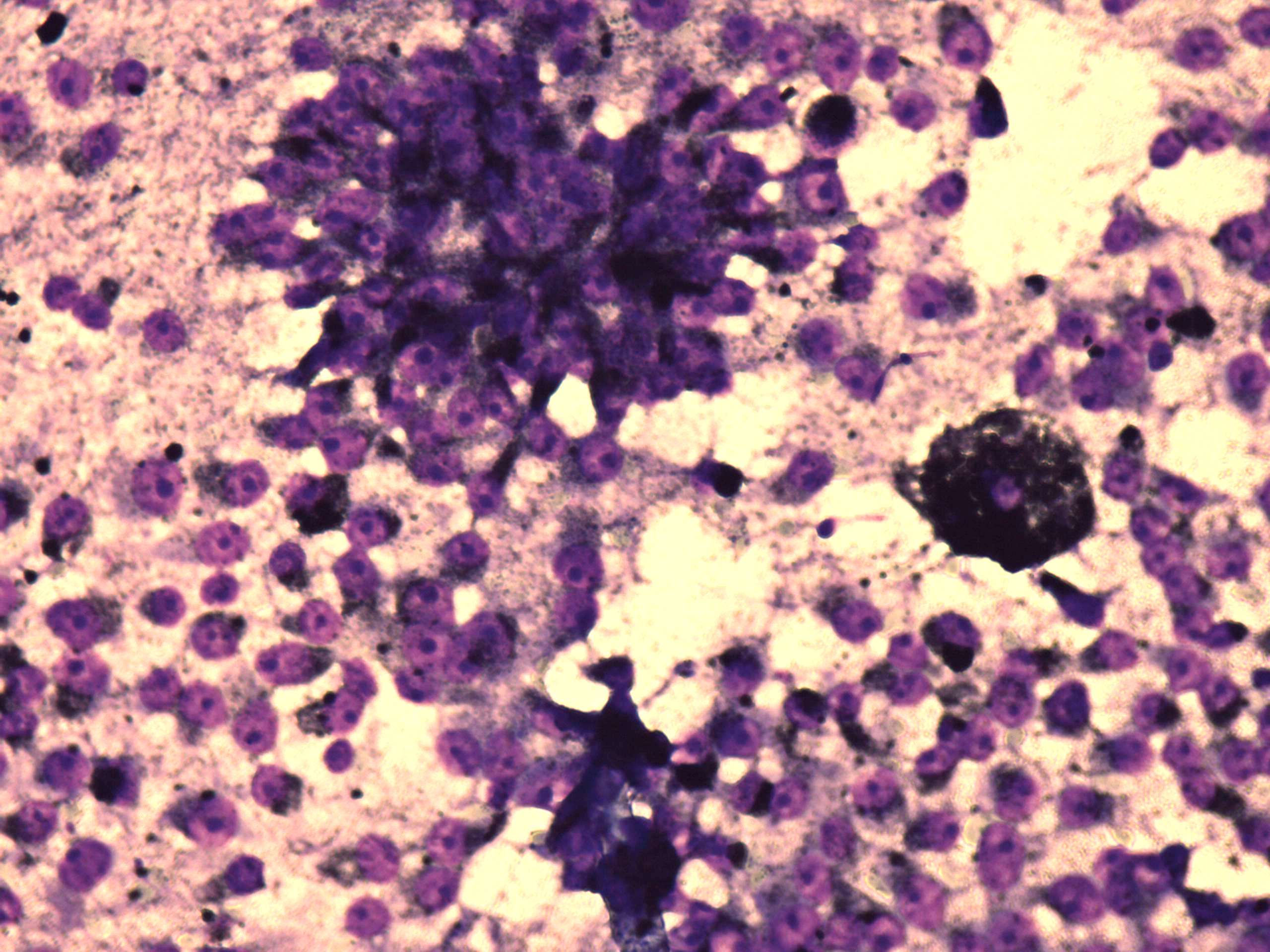 Right lobe, longitudinal scan