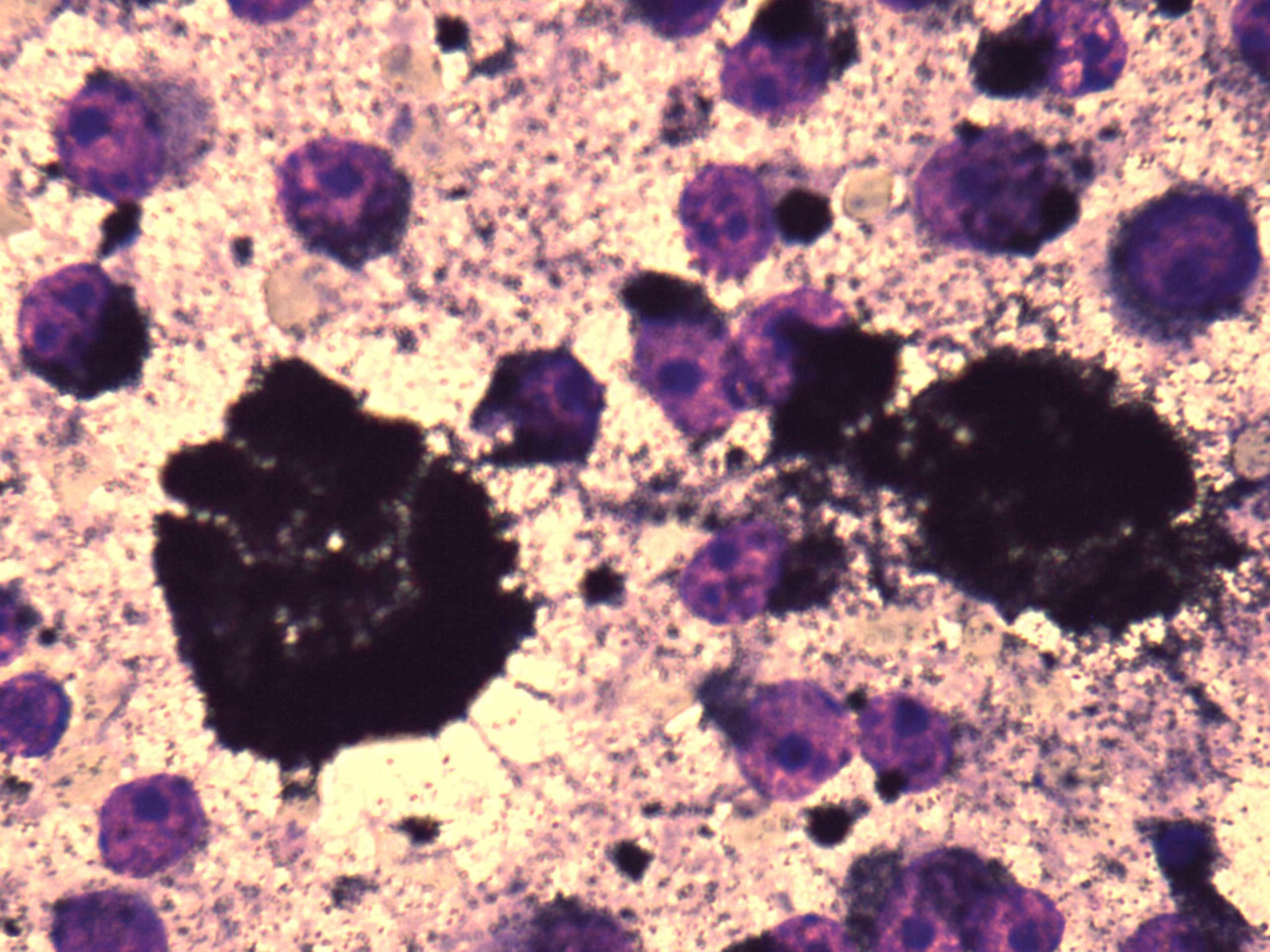 Right lobe, longitudinal scan