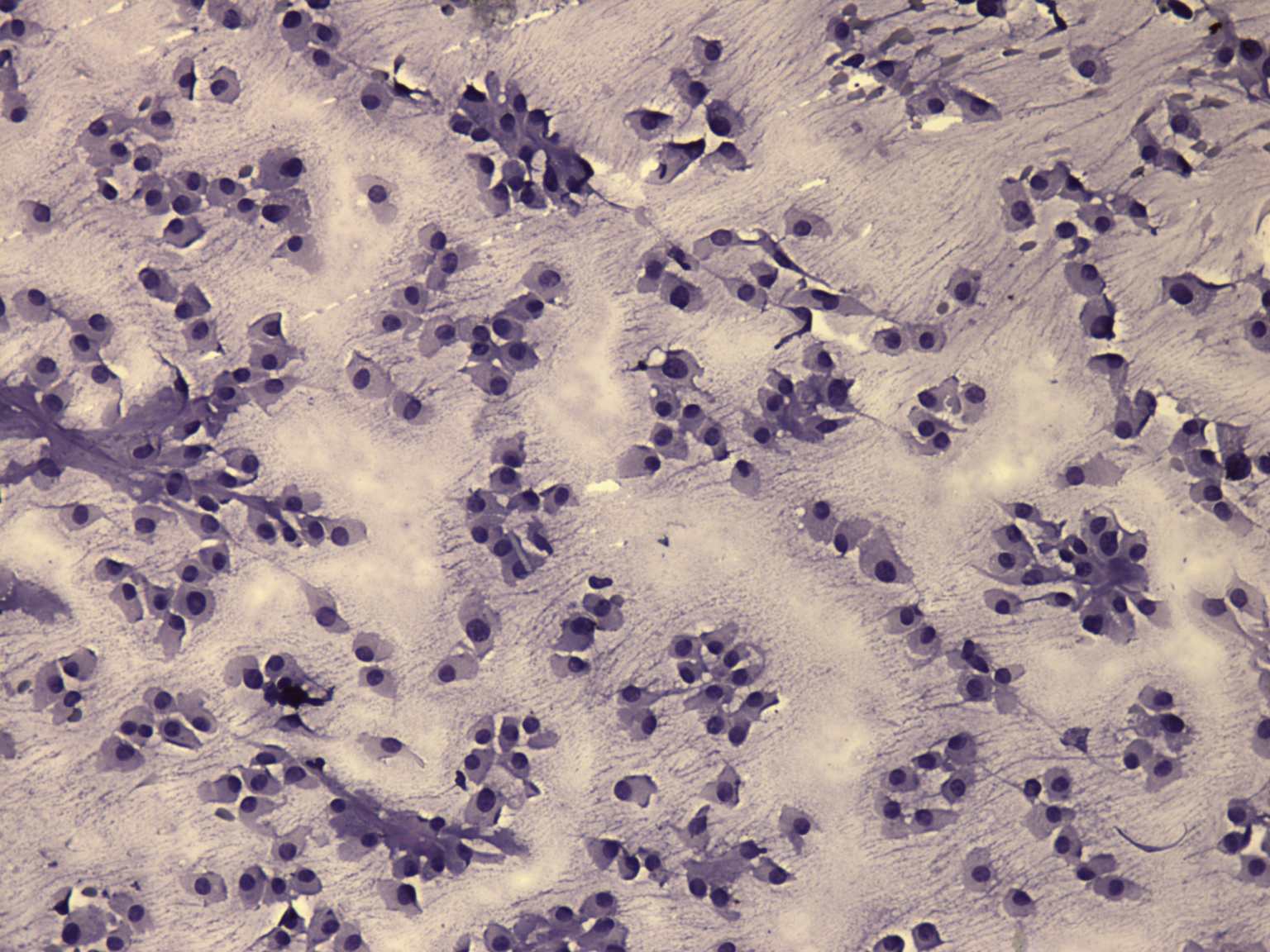 Right lobe, longitudinal scan