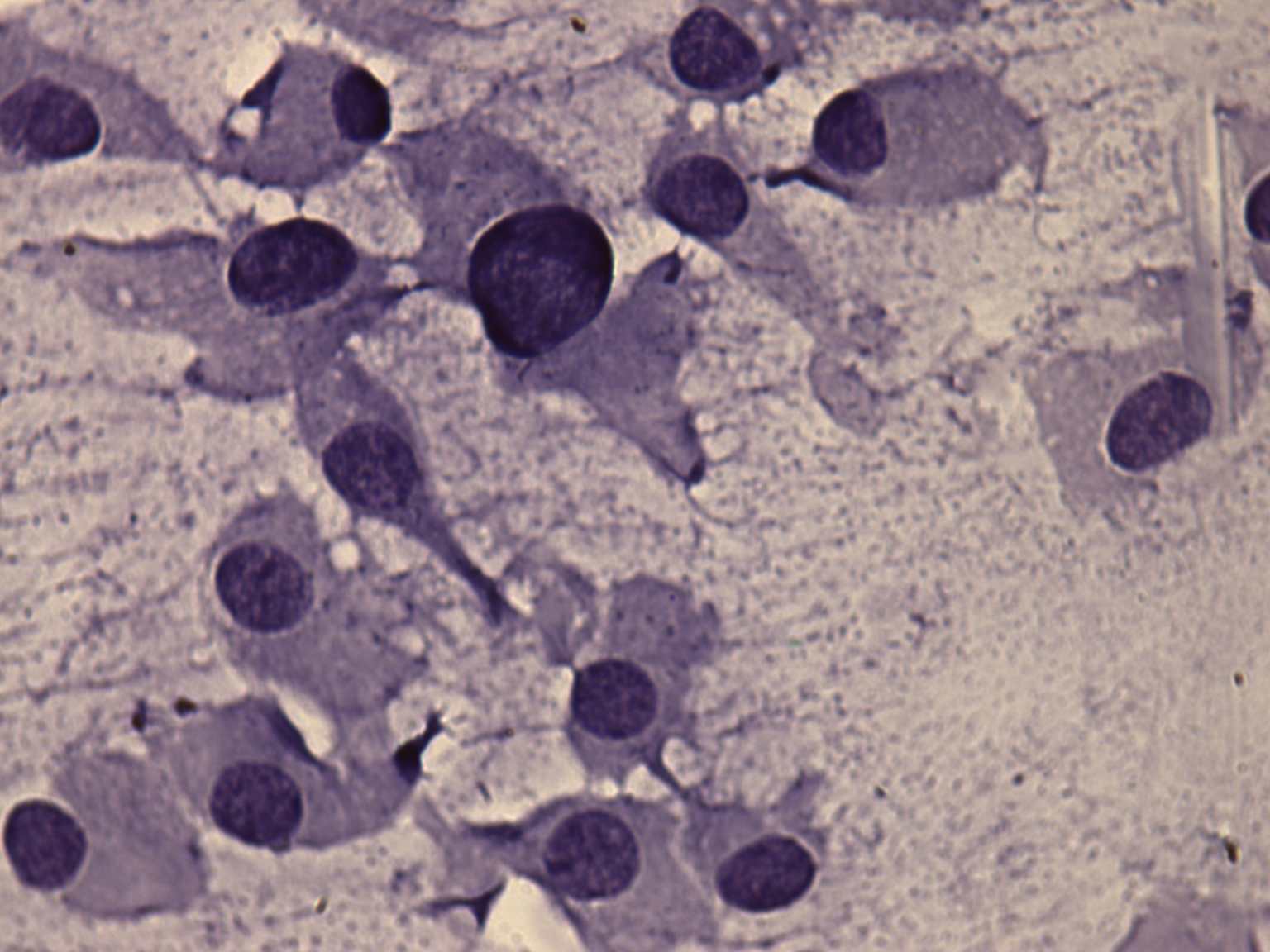 Right lobe, longitudinal scan