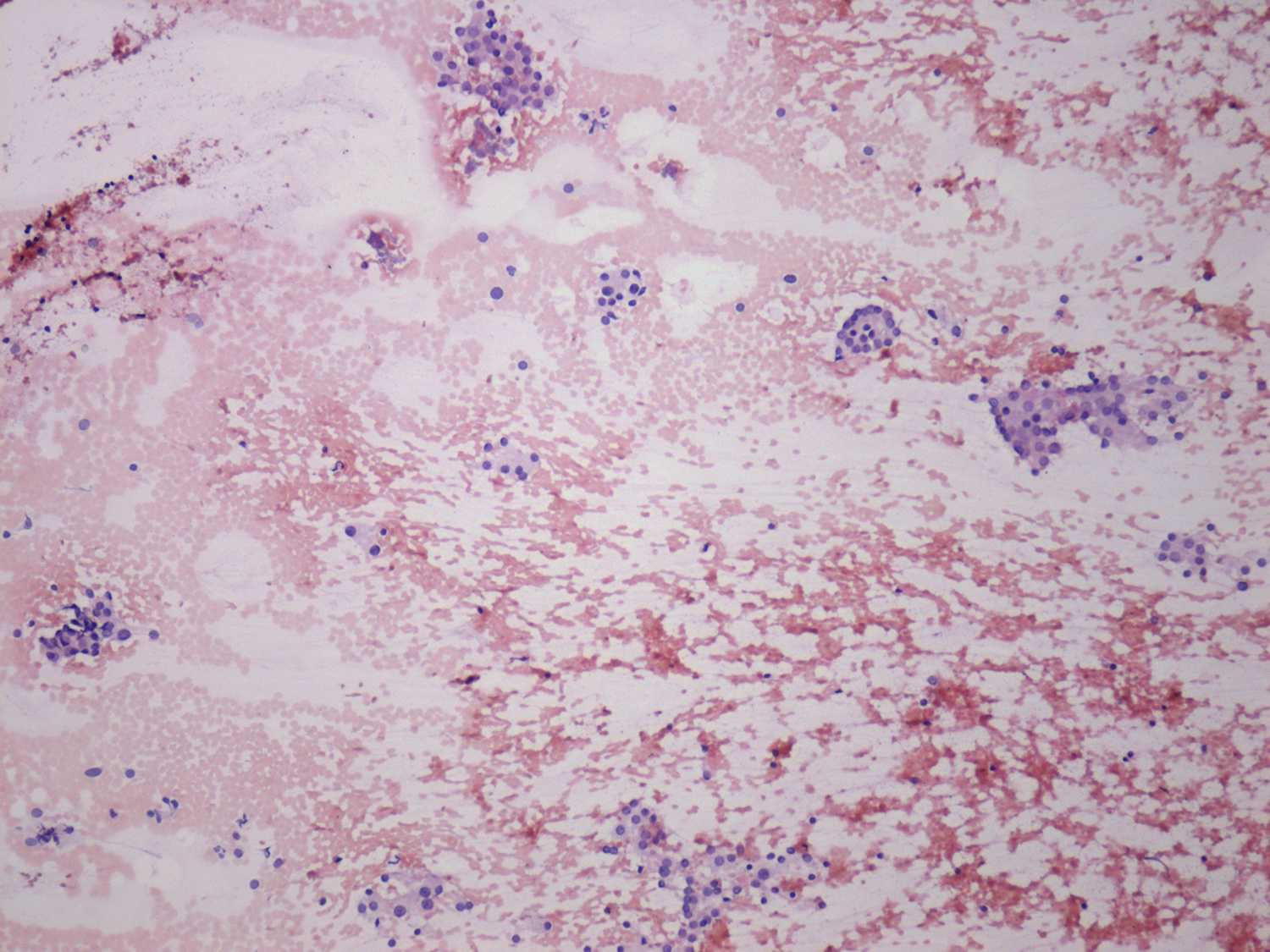 Right lobe, longitudinal scan
