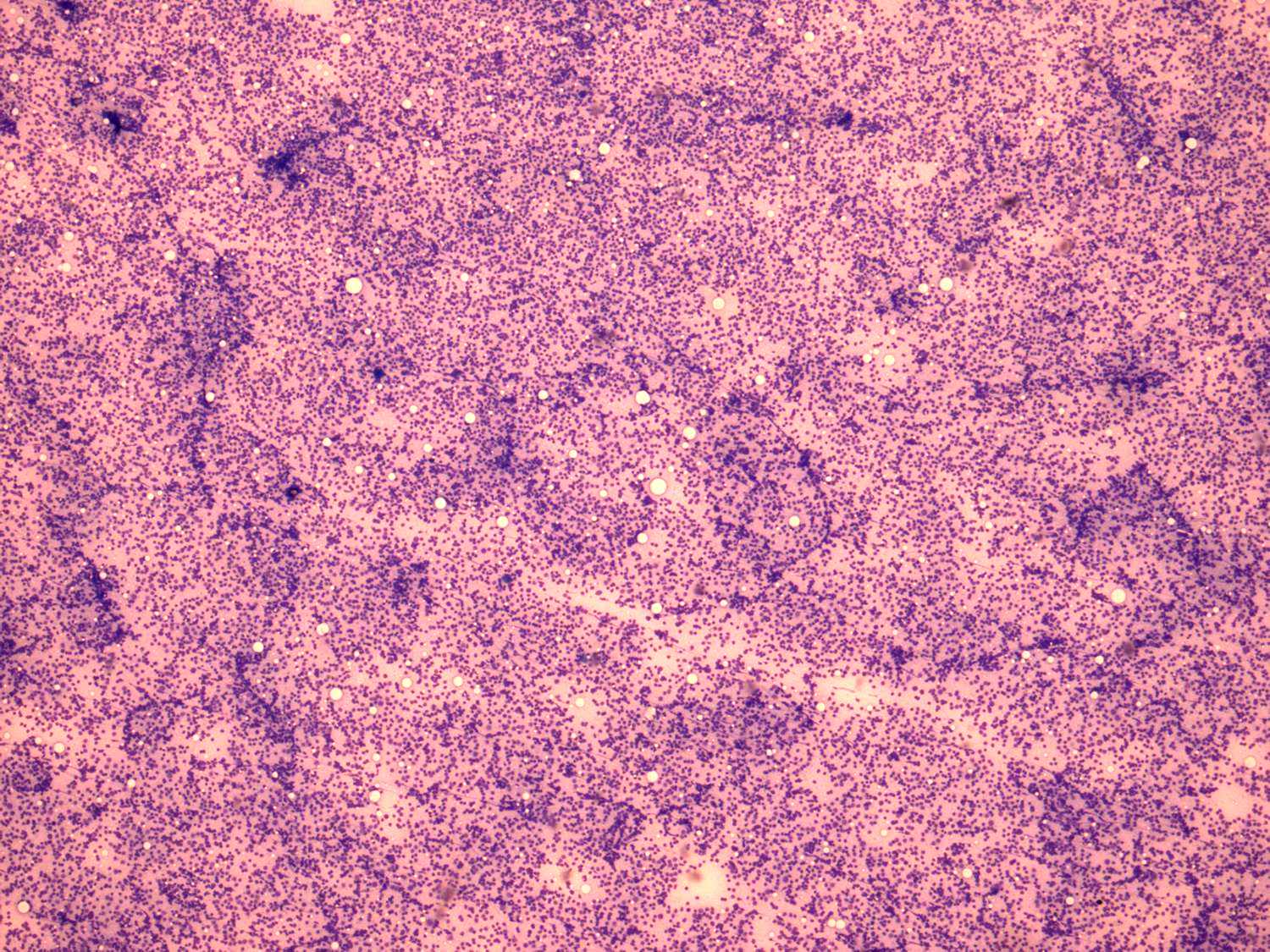 Right lobe, longitudinal scan