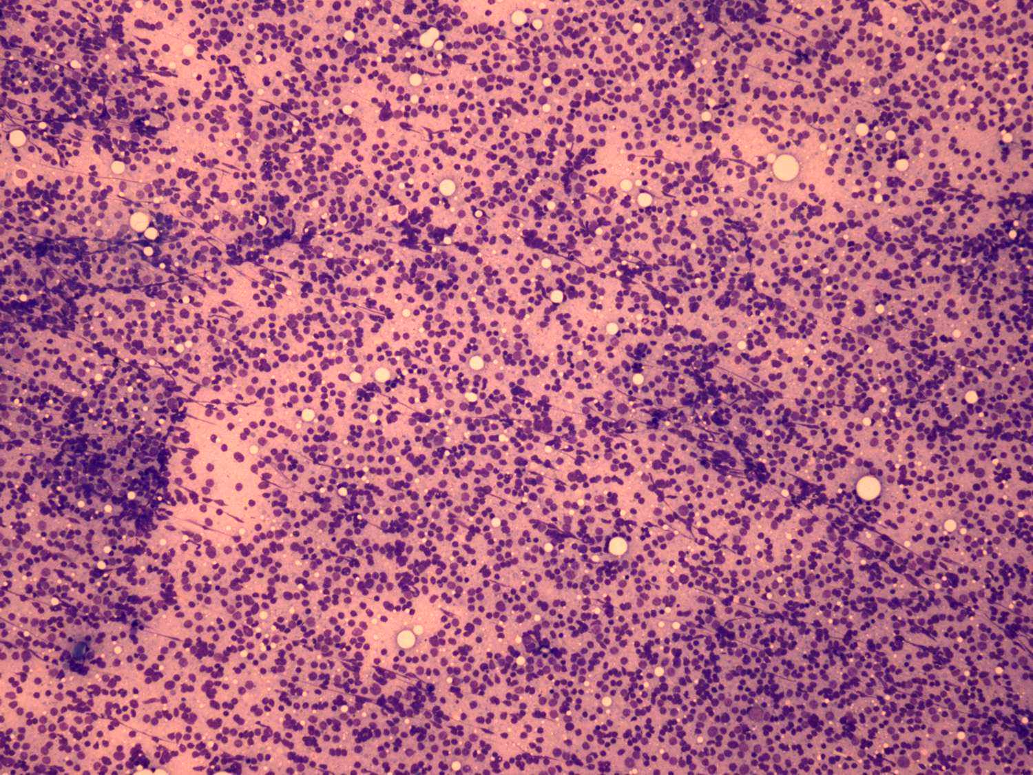 Right lobe, longitudinal scan