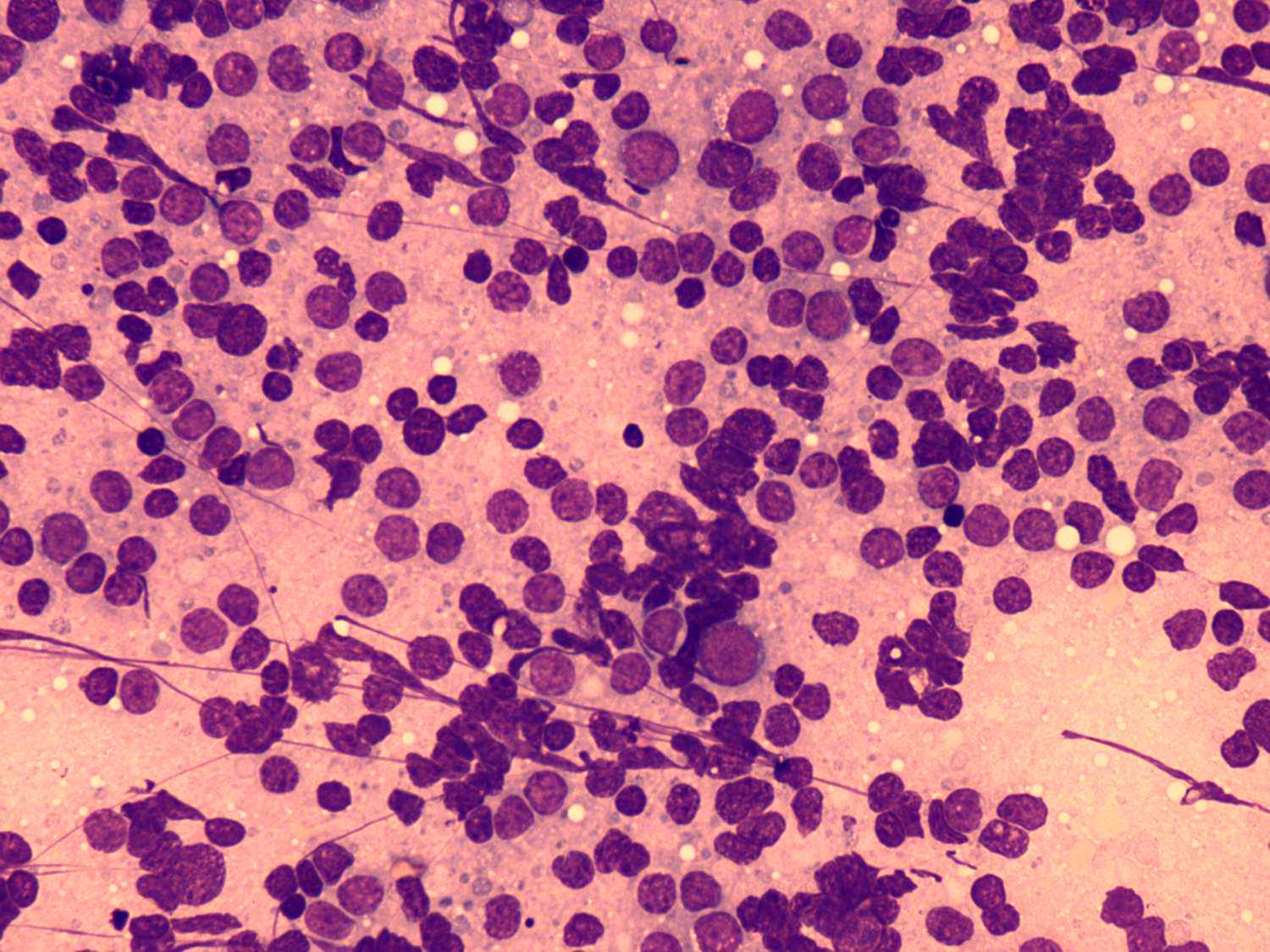 Right lobe, longitudinal scan