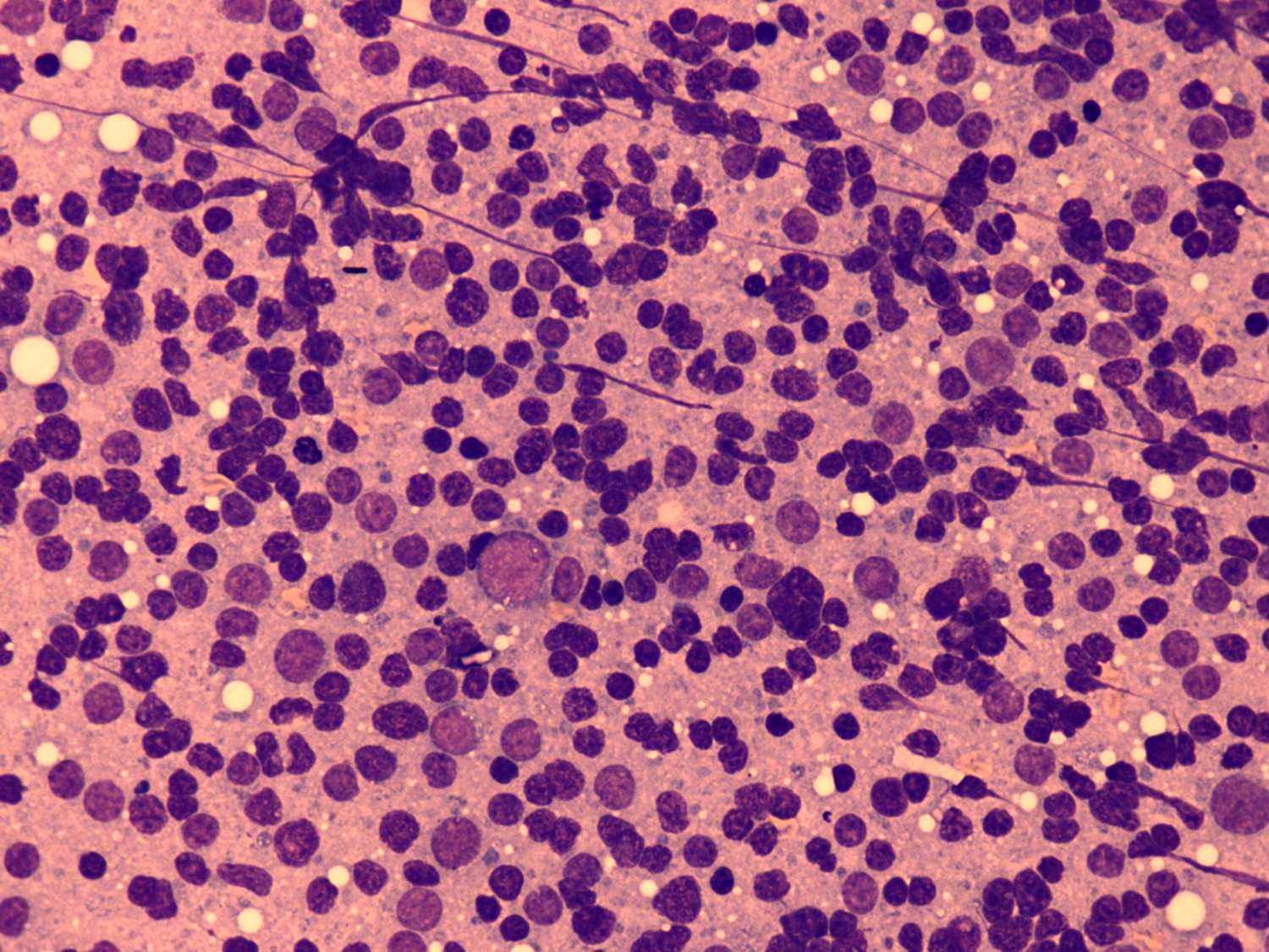 Right lobe, longitudinal scan