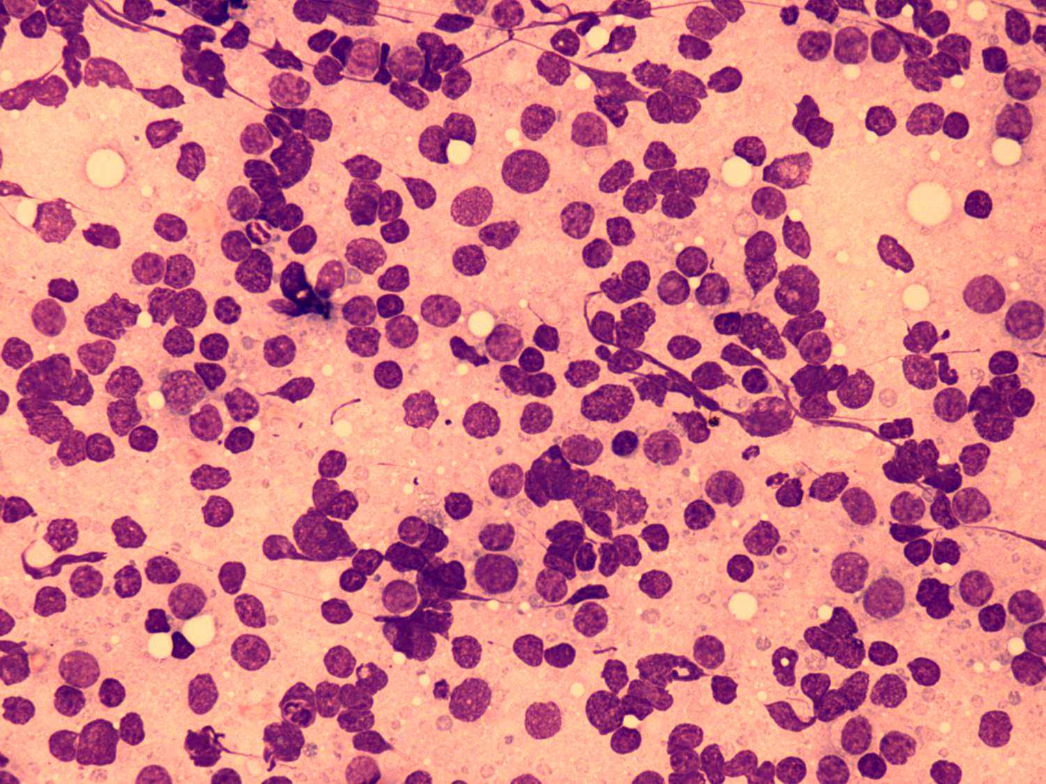Right lobe, longitudinal scan