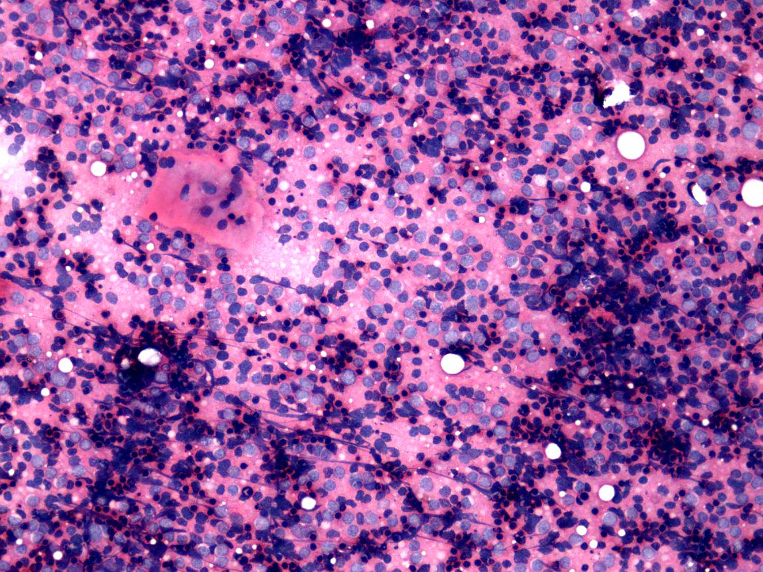 Right lobe, longitudinal scan
