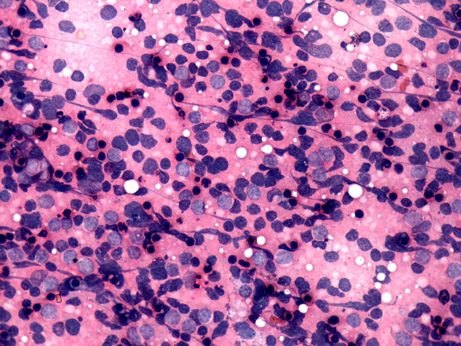 Right lobe, longitudinal scan