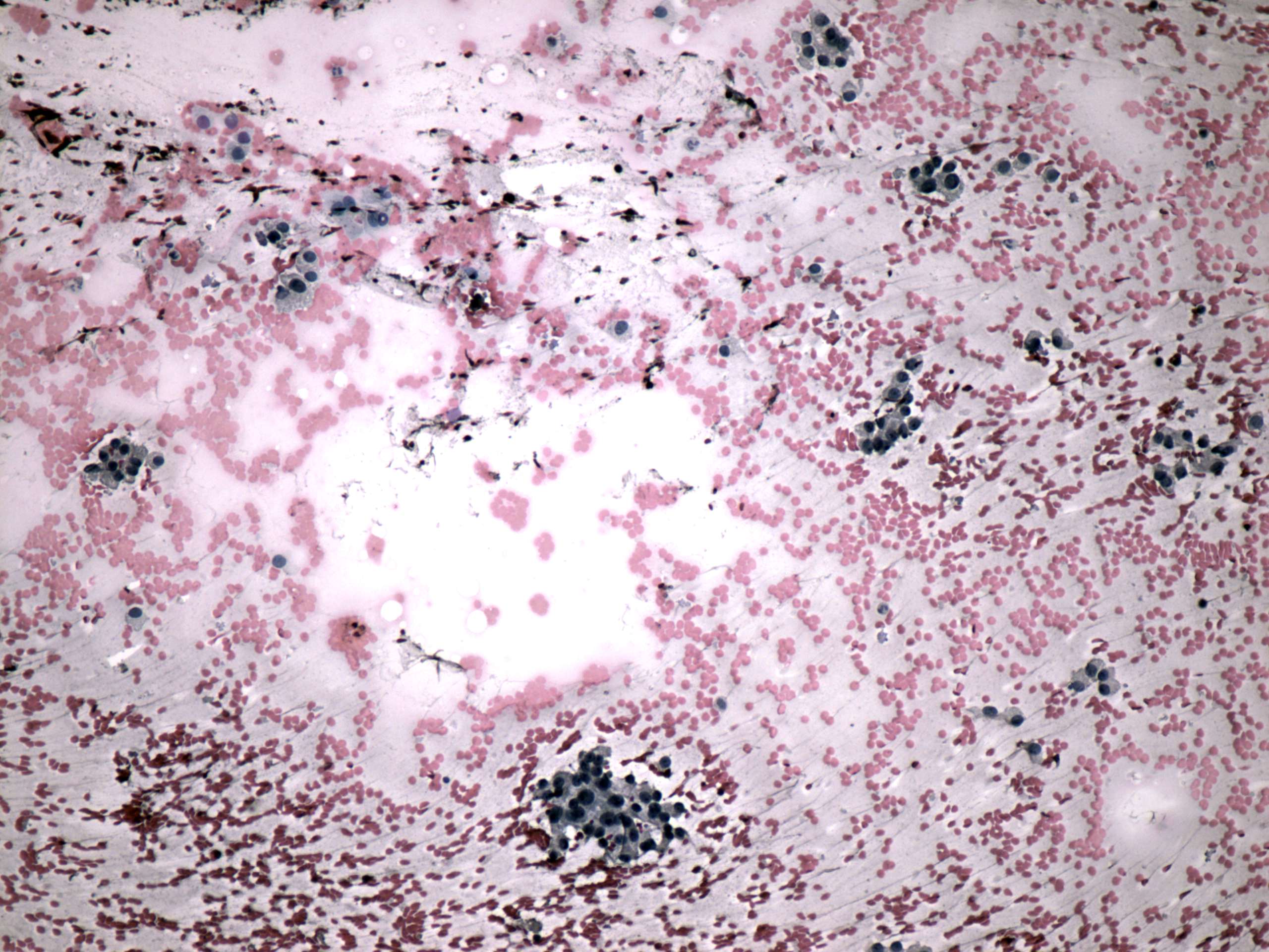 Right lobe, longitudinal scan