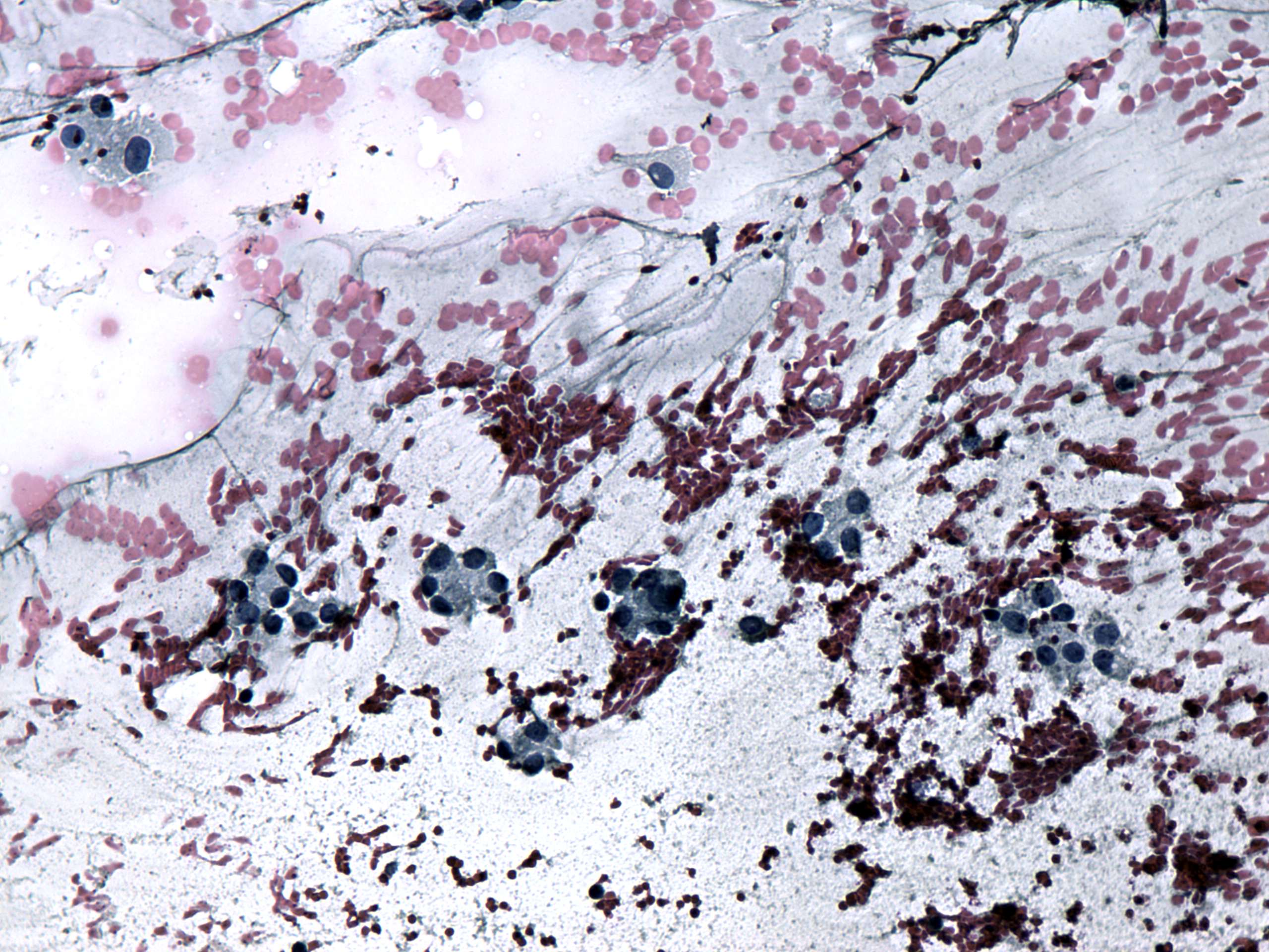 Right lobe, longitudinal scan