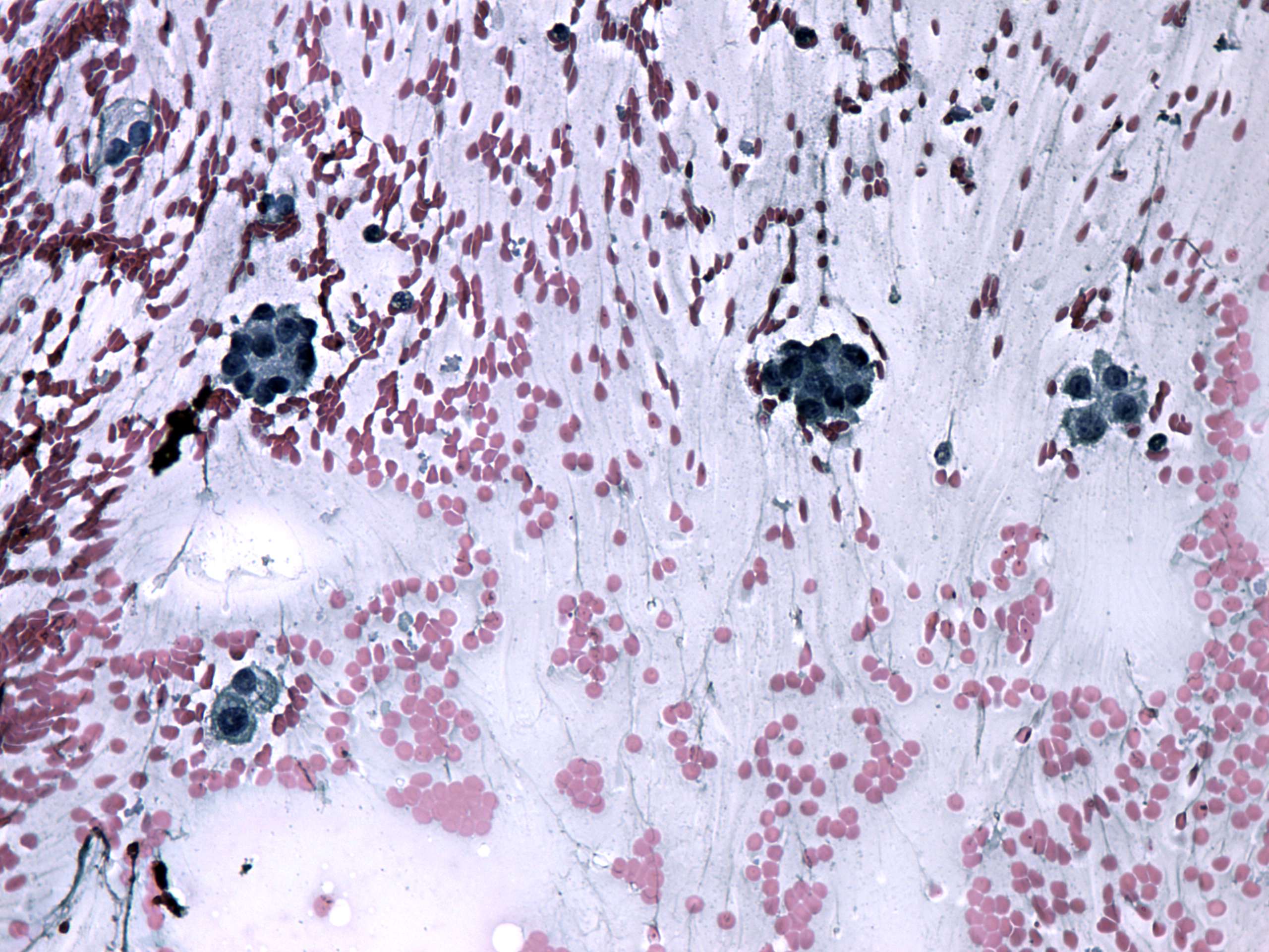 Right lobe, longitudinal scan