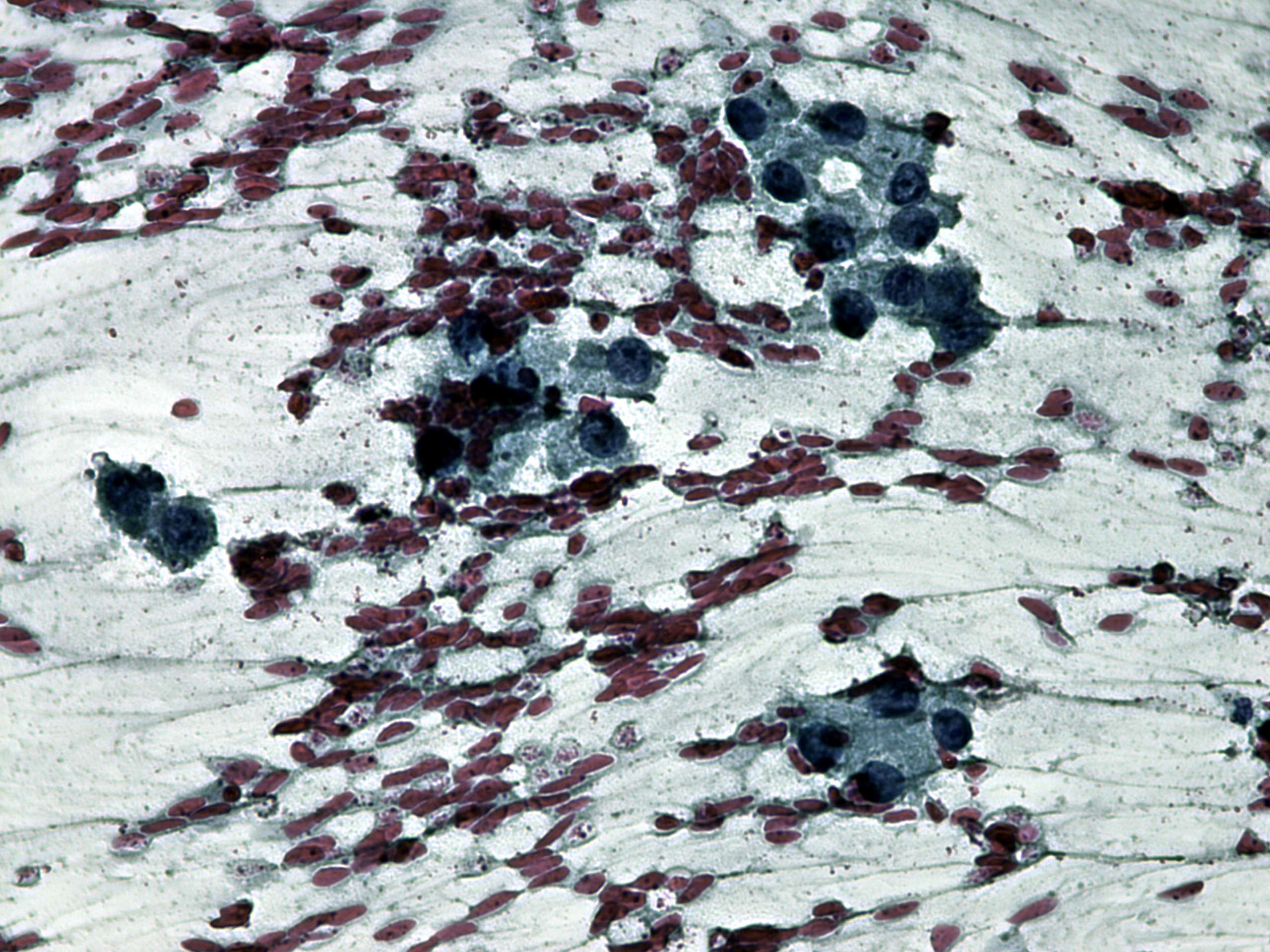 Right lobe, longitudinal scan