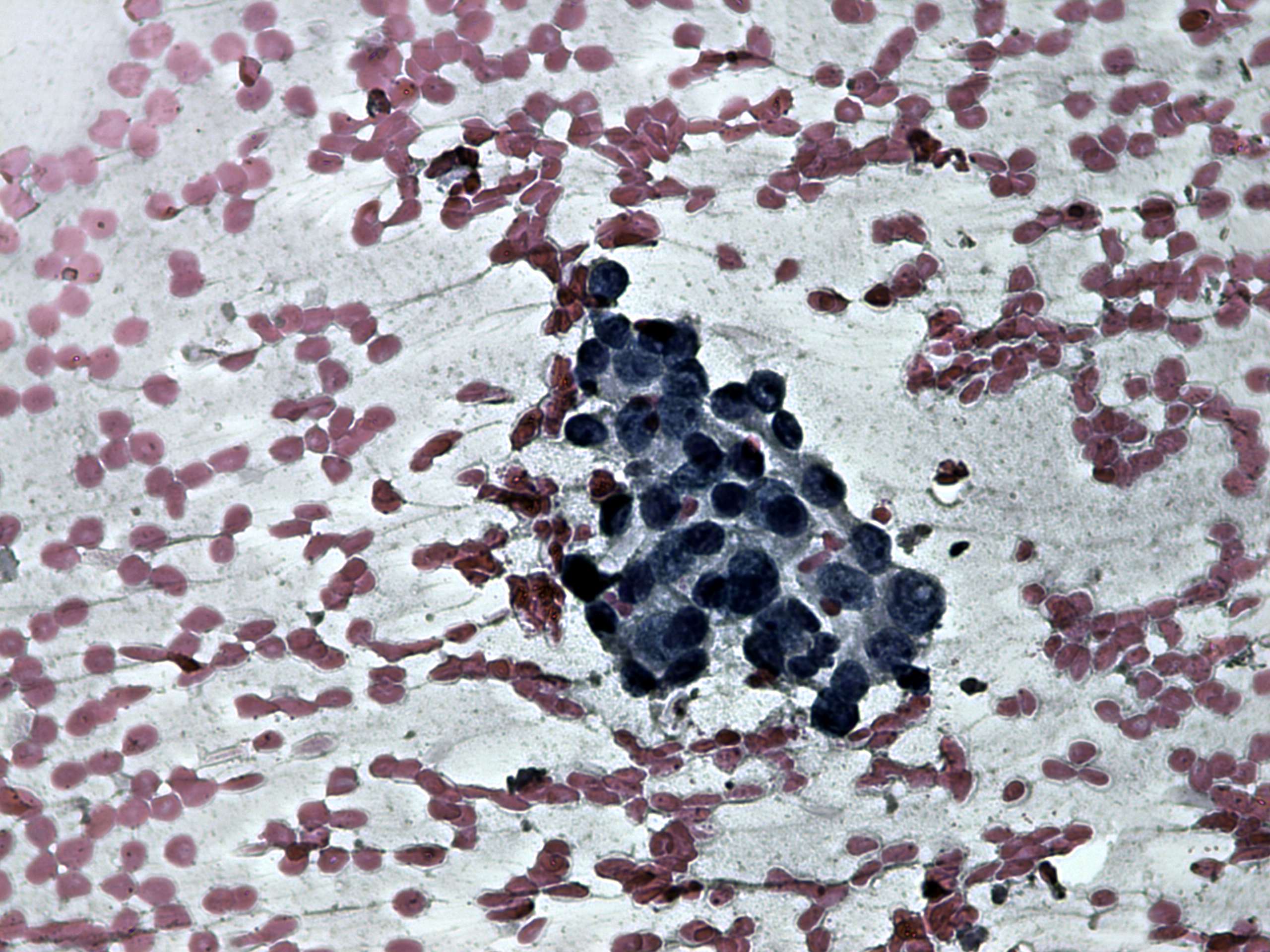 Right lobe, longitudinal scan