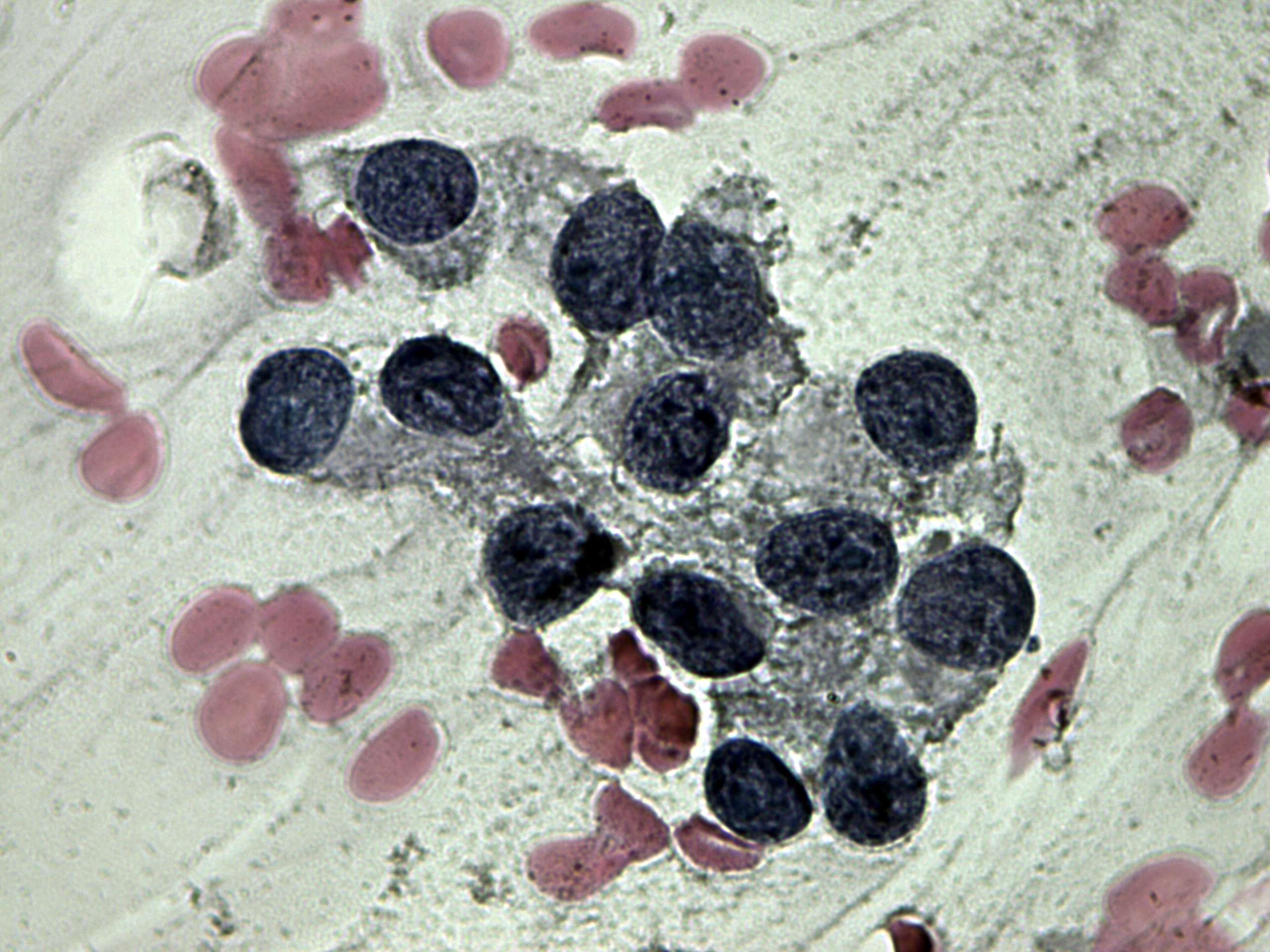 Right lobe, longitudinal scan