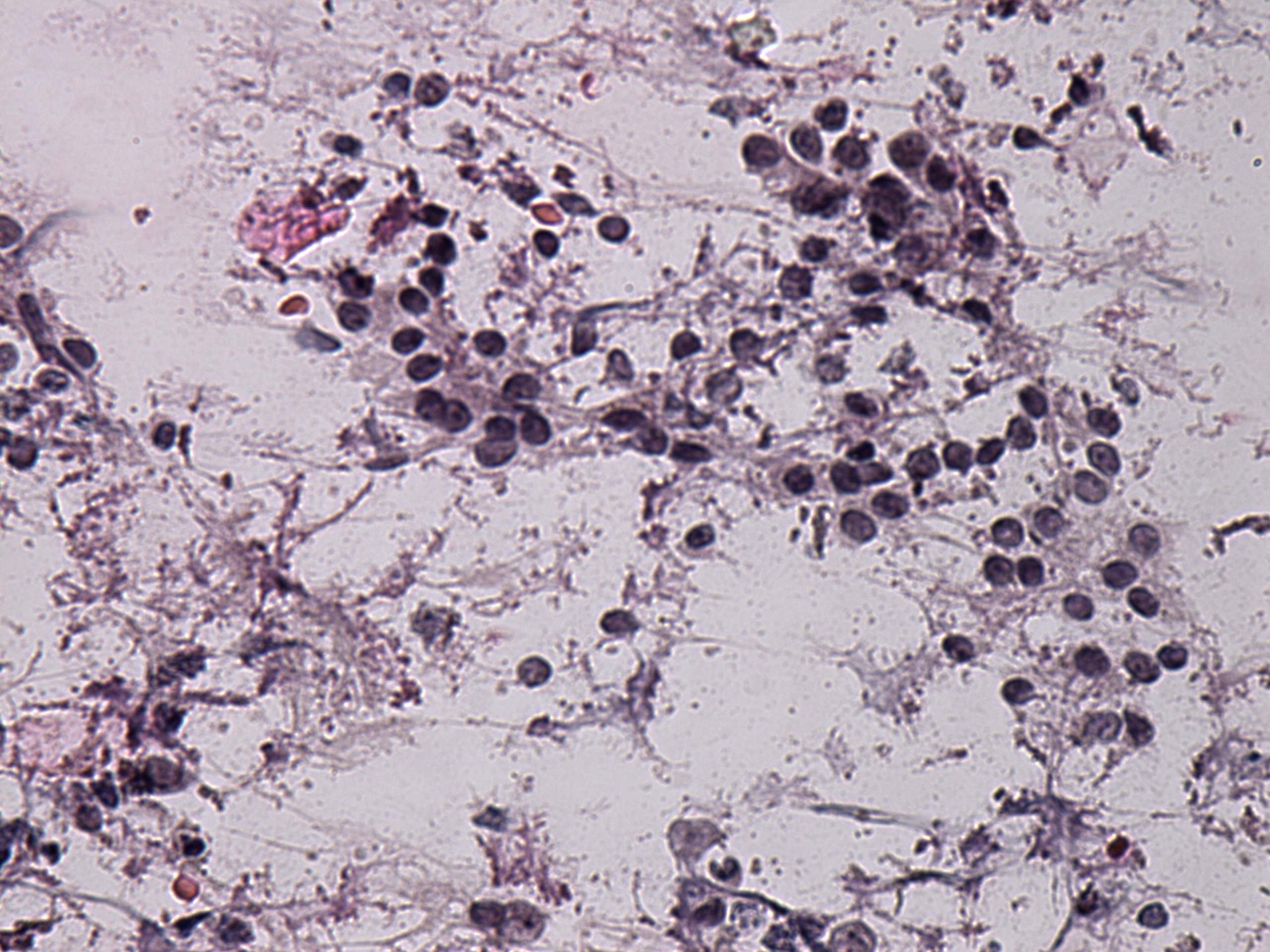 Right lobe, longitudinal scan