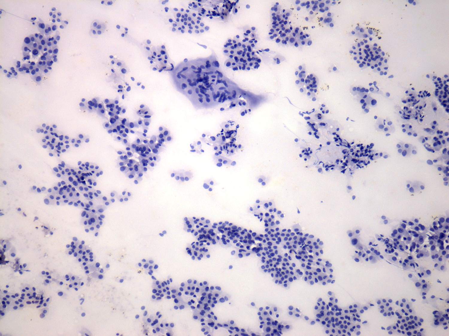 Right lobe, longitudinal scan