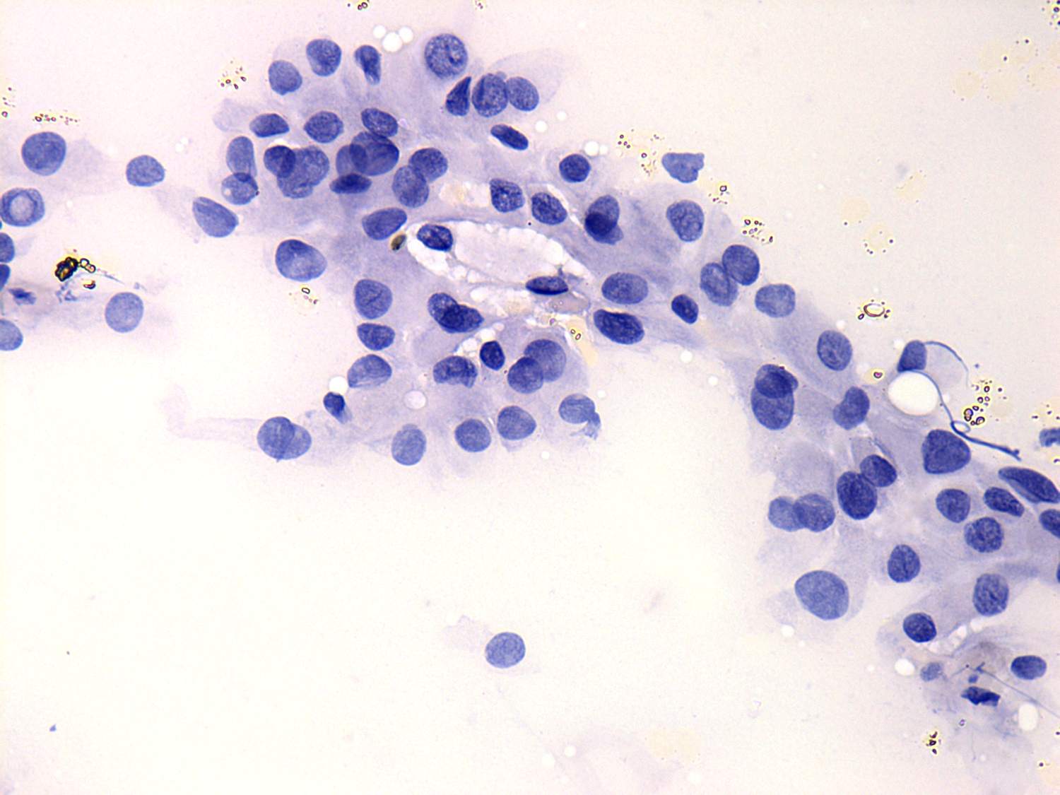 Right lobe, longitudinal scan