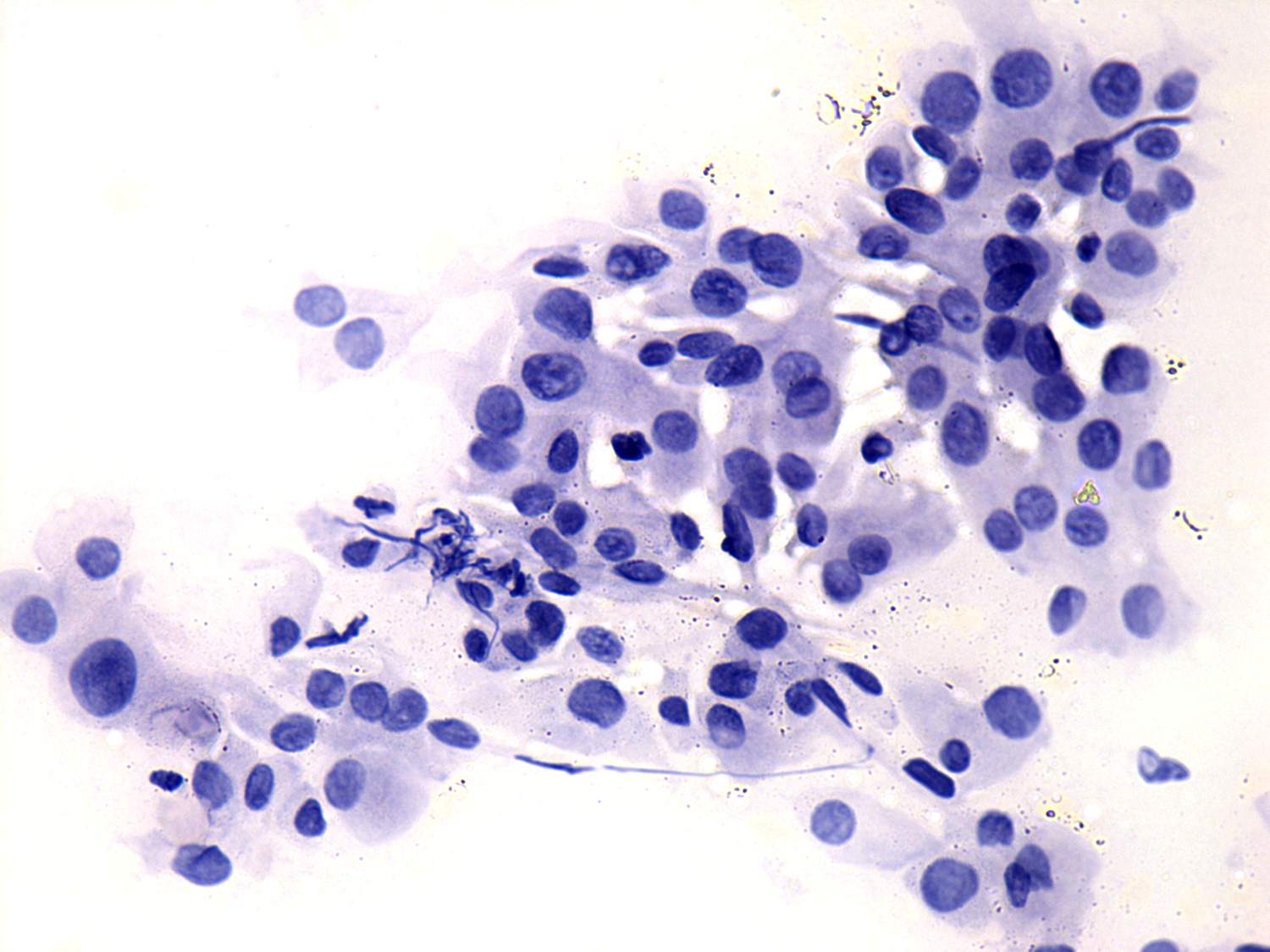 Right lobe, longitudinal scan