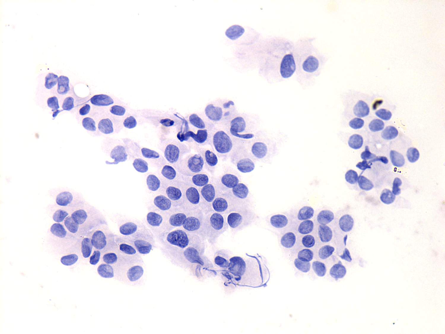 Right lobe, longitudinal scan