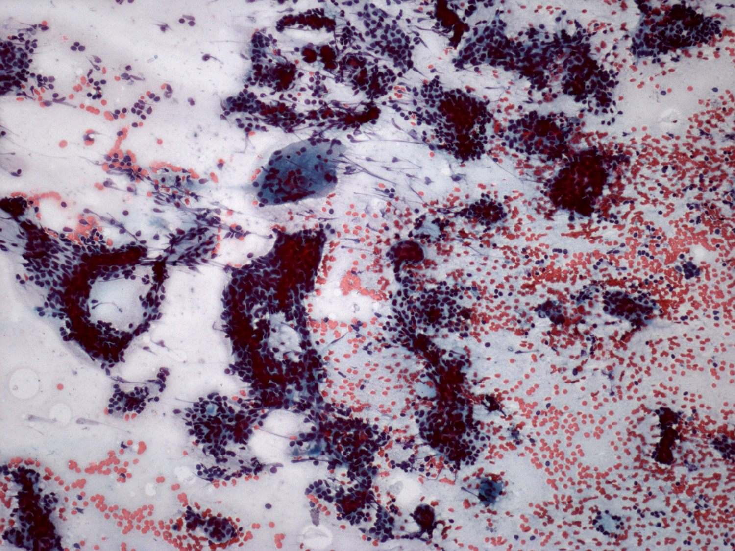 Right lobe, longitudinal scan