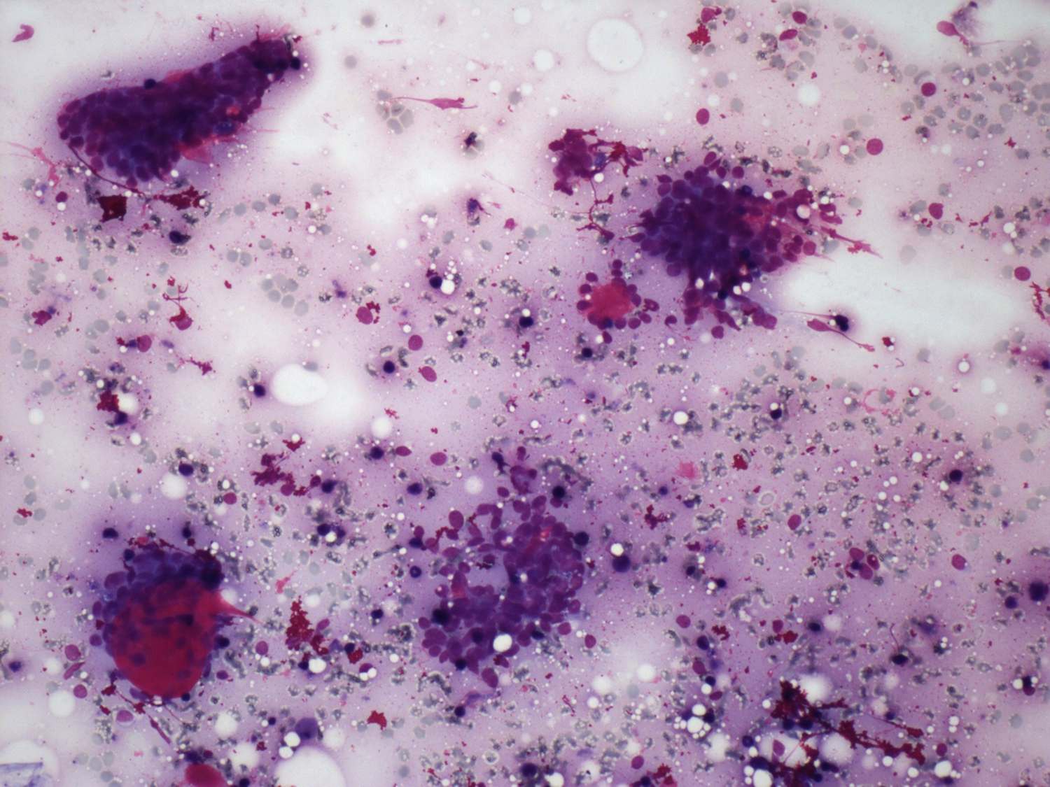 Right lobe, longitudinal scan