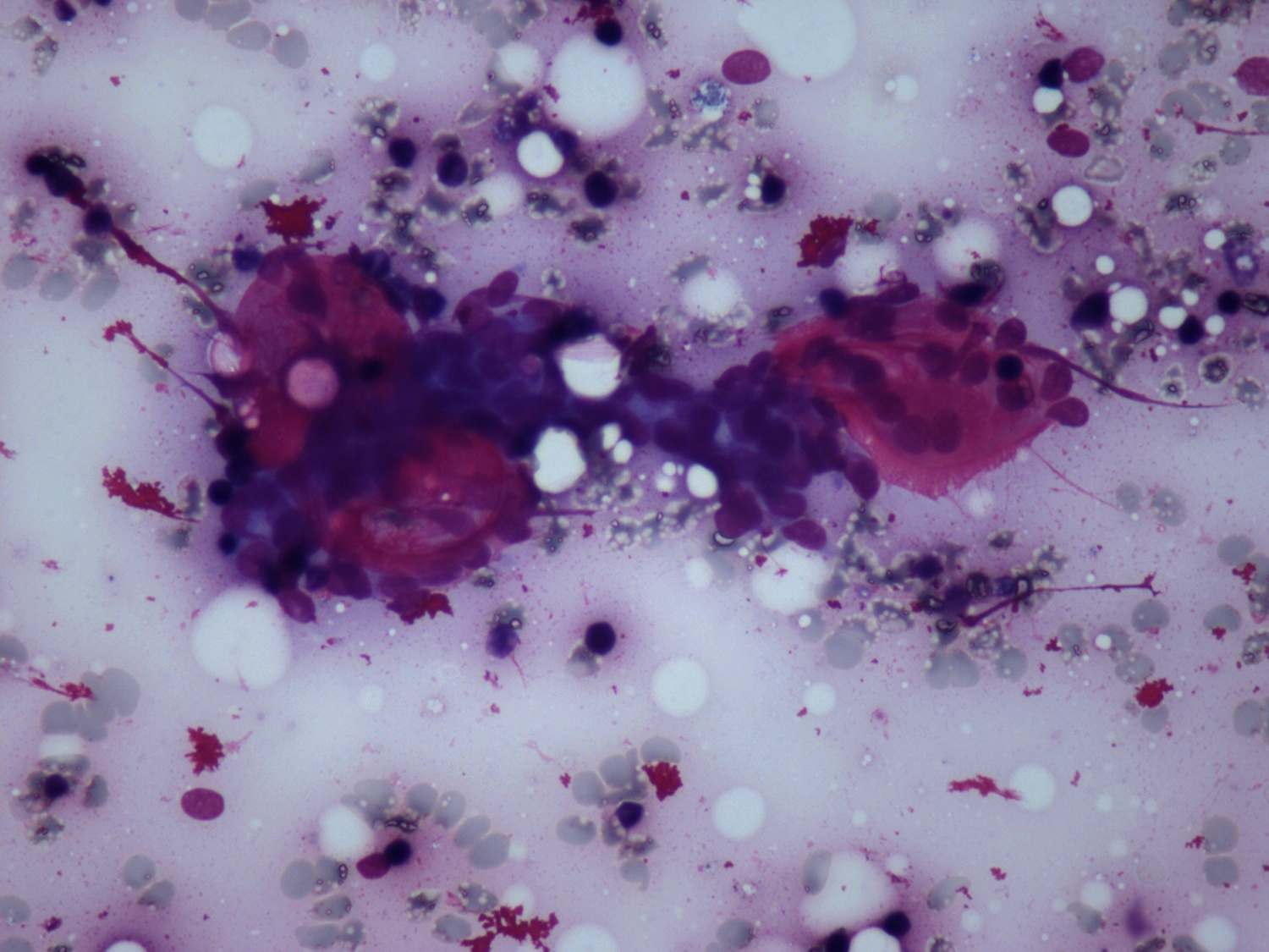 Right lobe, longitudinal scan