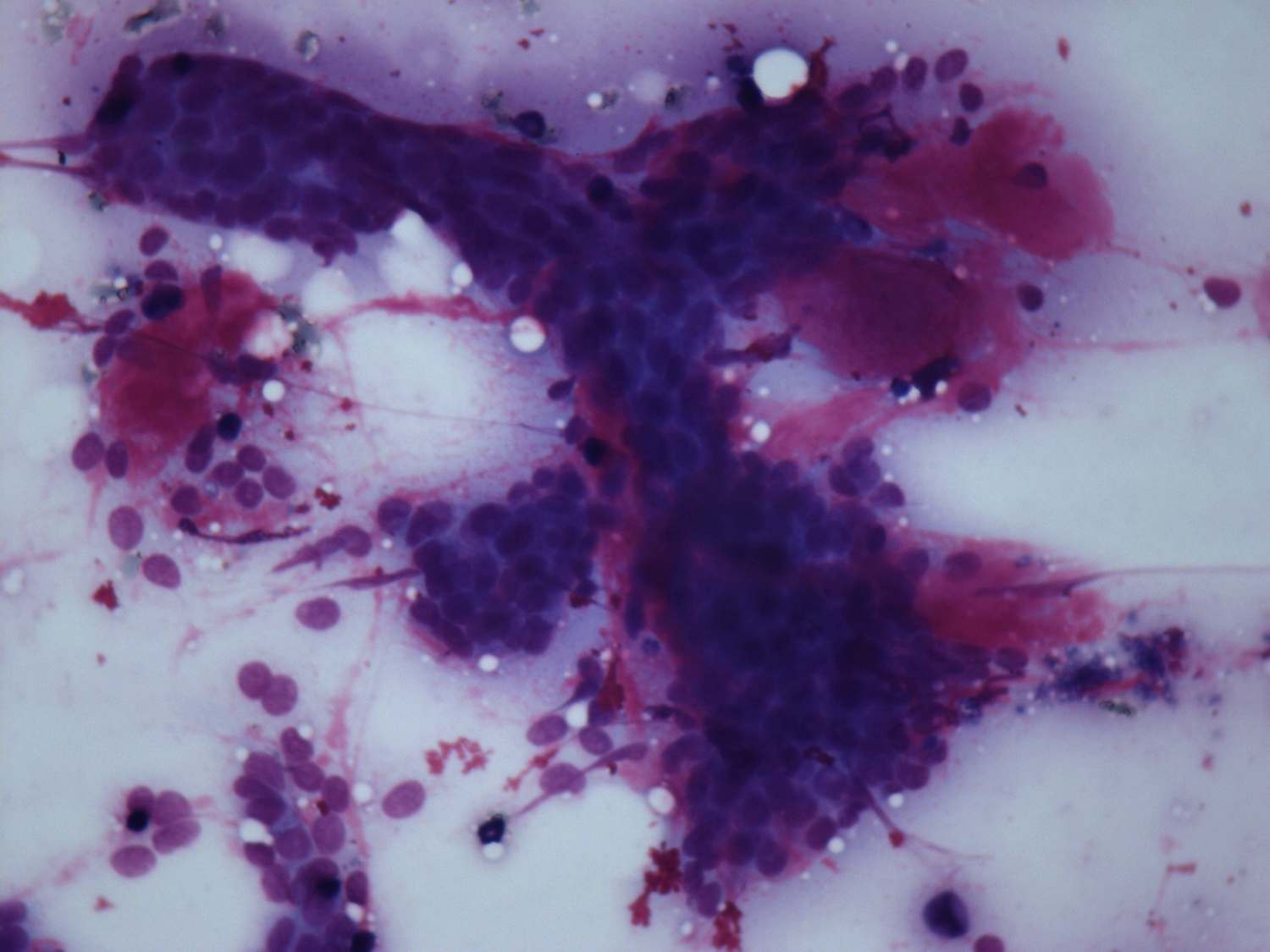 Right lobe, longitudinal scan