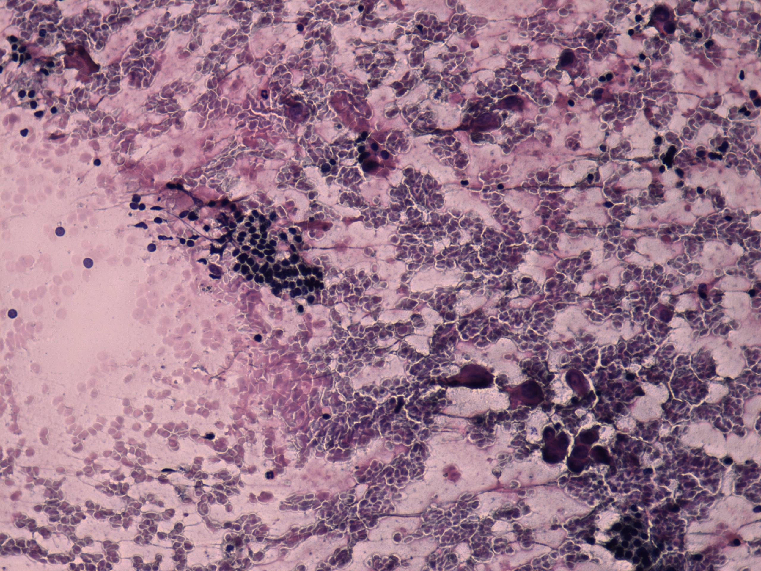 Right lobe, longitudinal scan