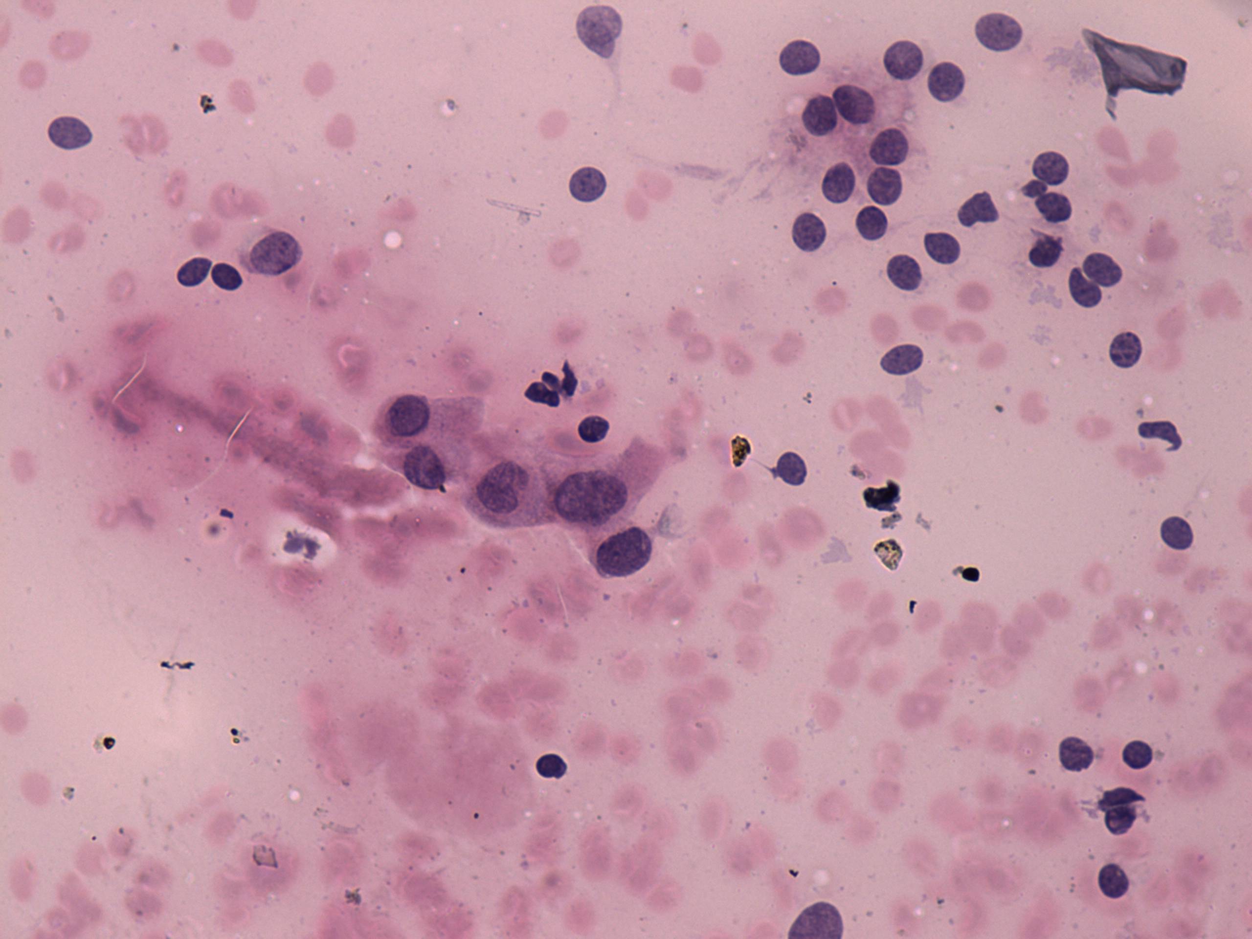 Right lobe, longitudinal scan