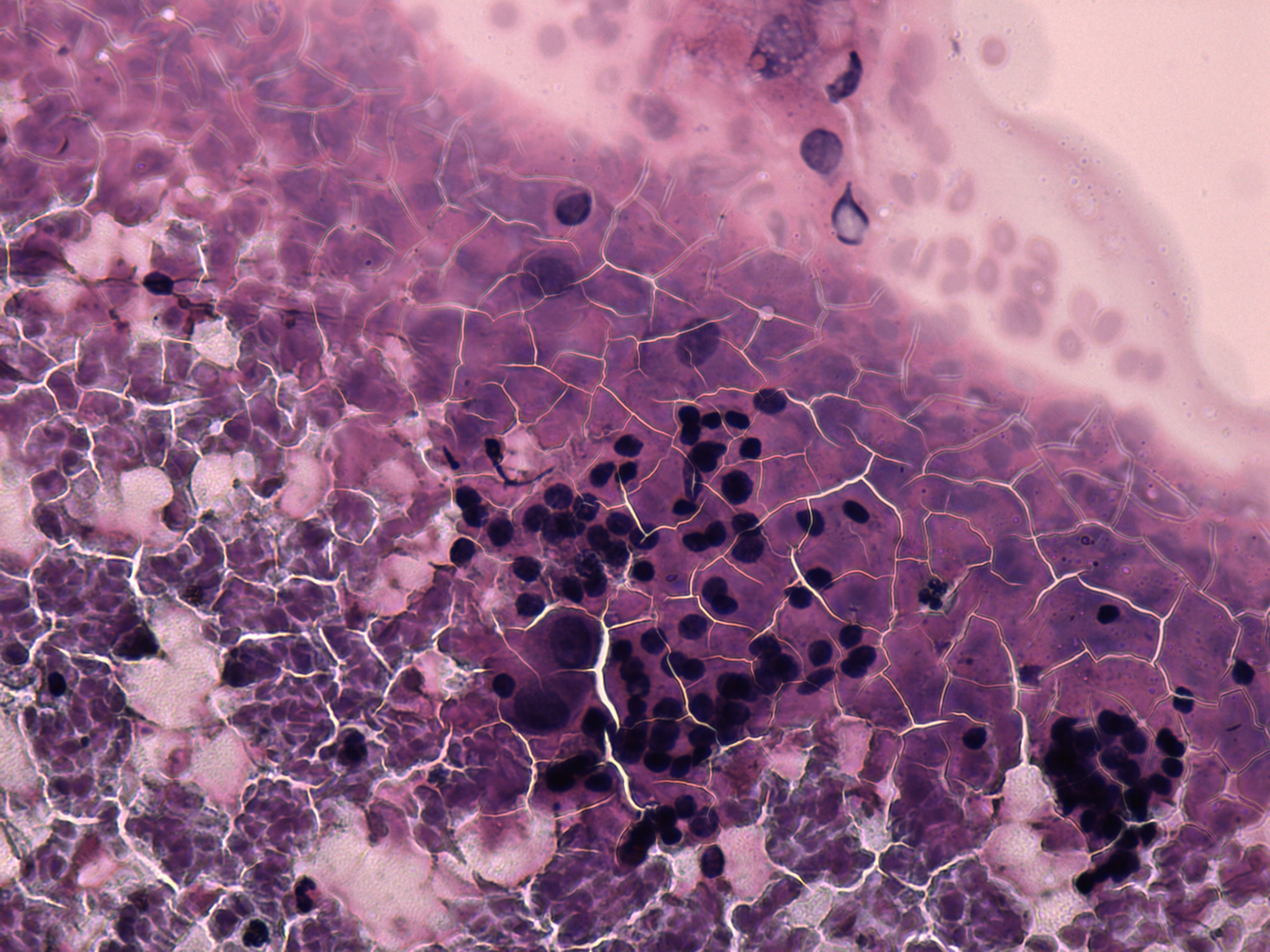 Right lobe, longitudinal scan