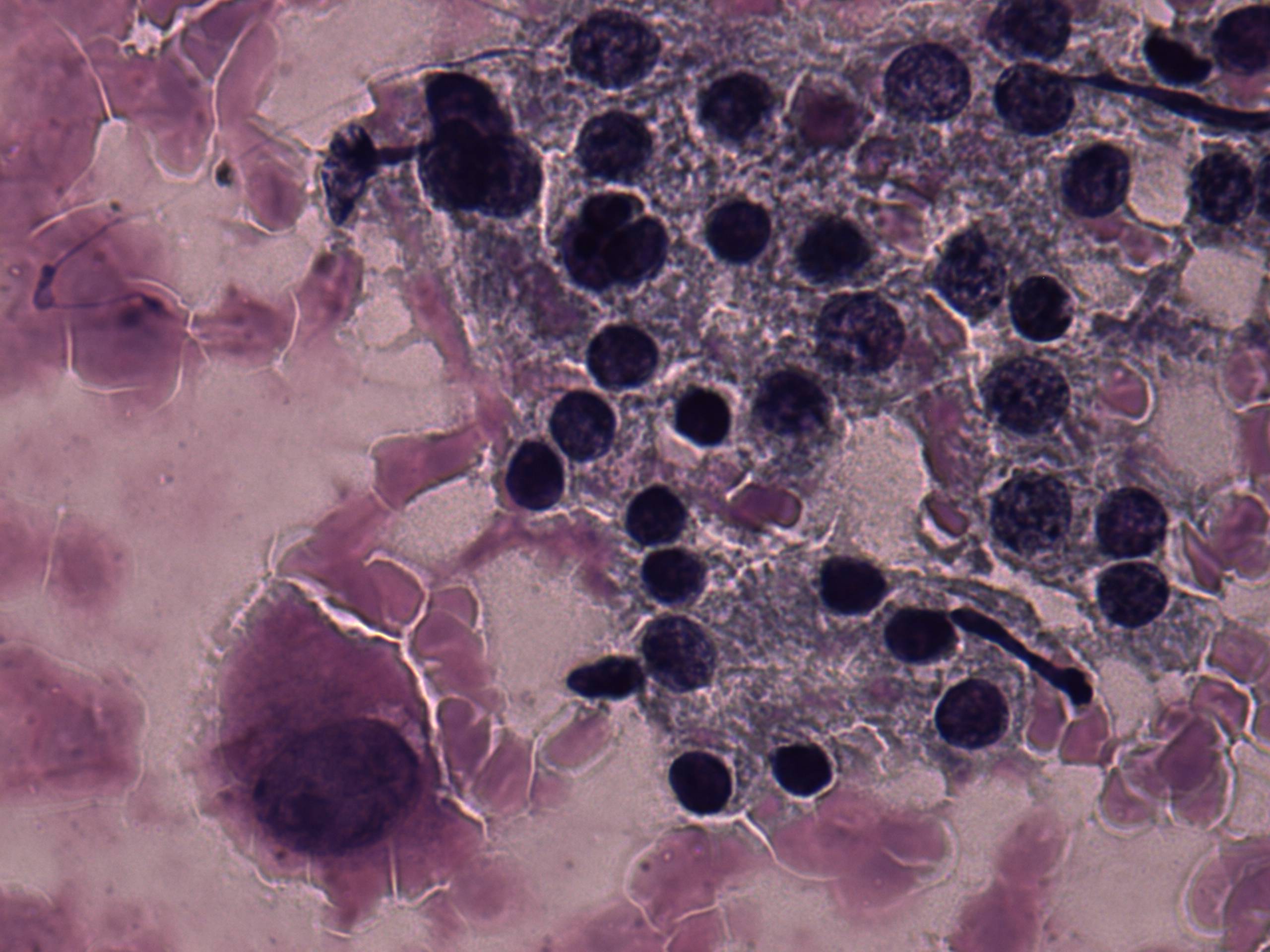 Right lobe, longitudinal scan