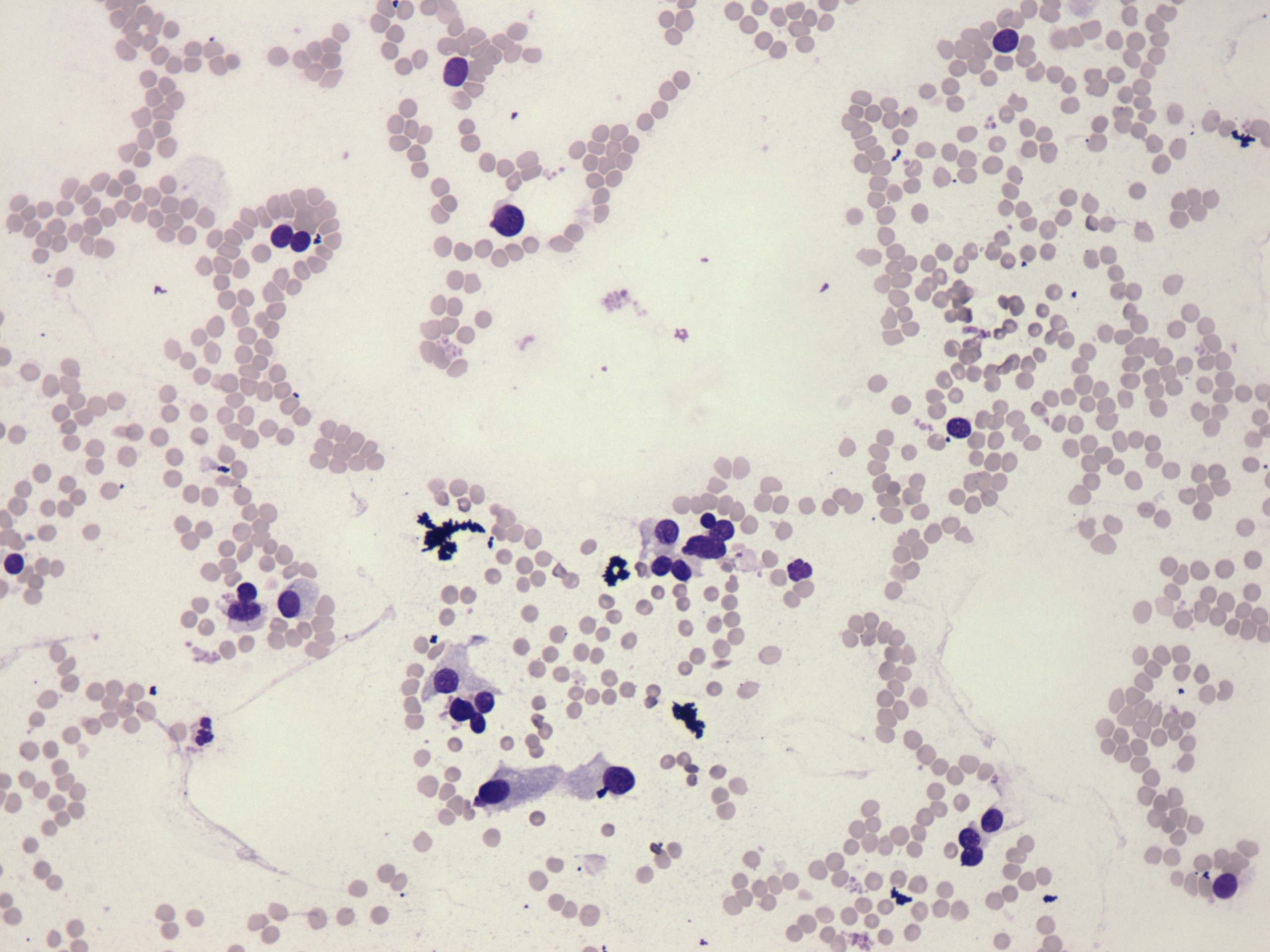 Right lobe, longitudinal scan
