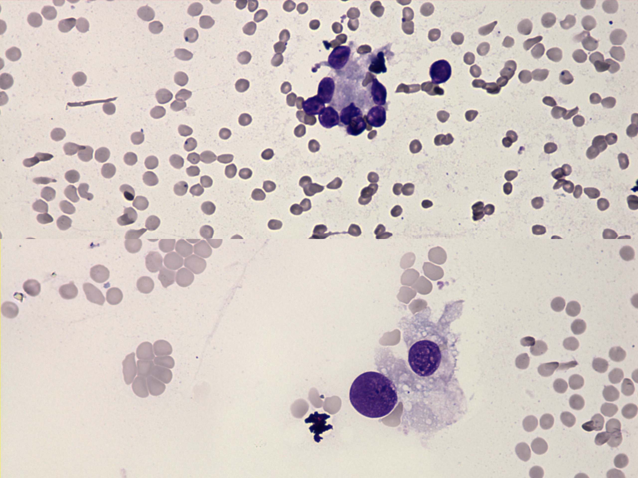 Right lobe, longitudinal scan
