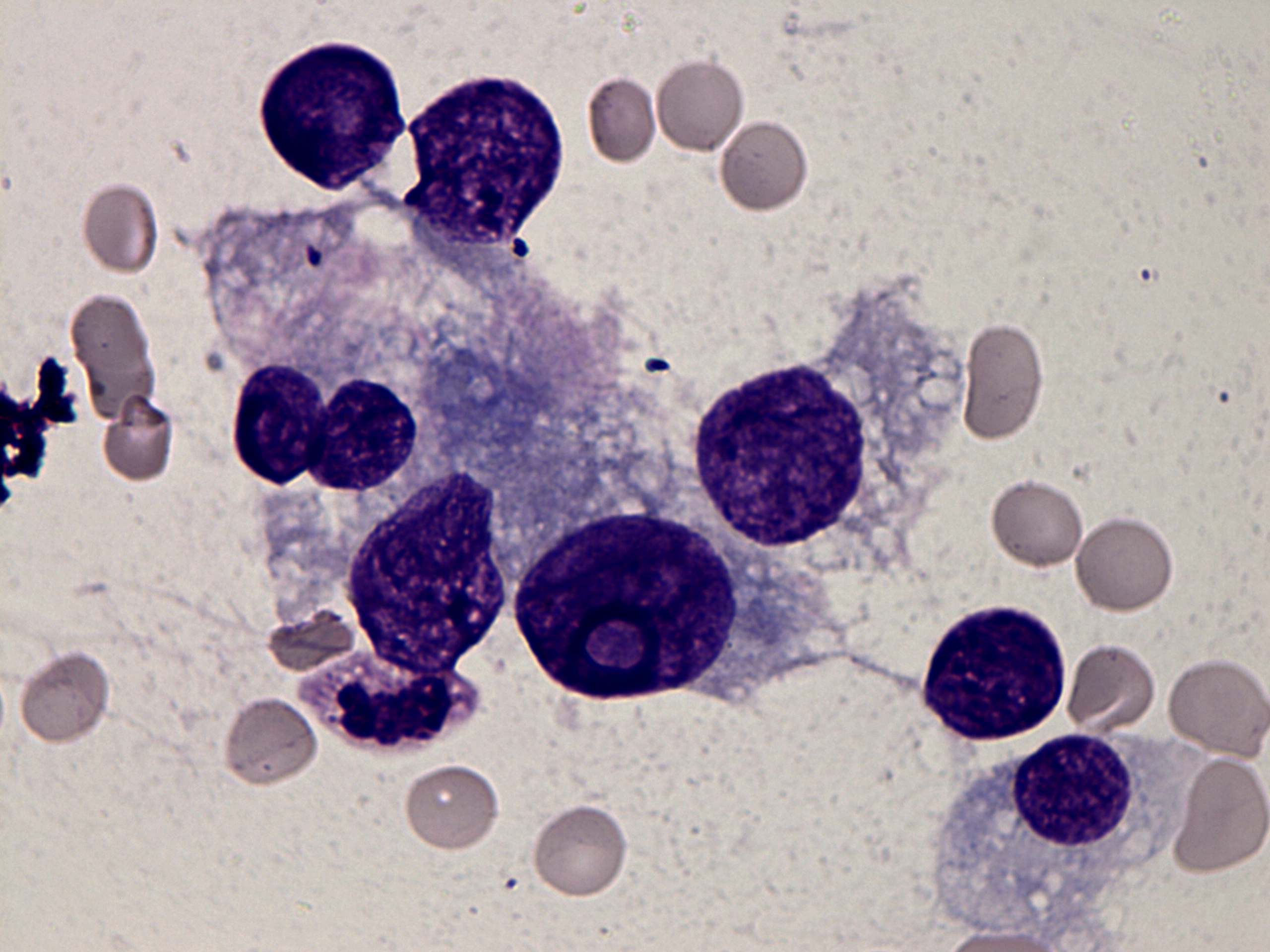 Right lobe, longitudinal scan
